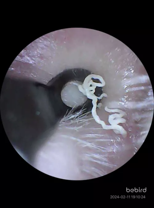 Ear blackhead that pops every so often by motherofhobbitses