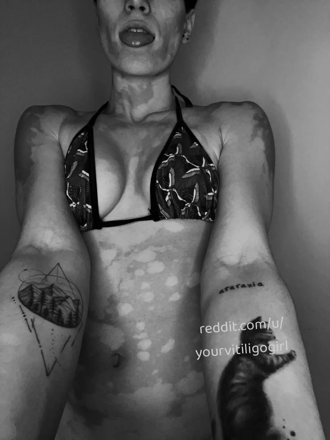 Join me in a swim race (f) posted by yourvitiligogirl