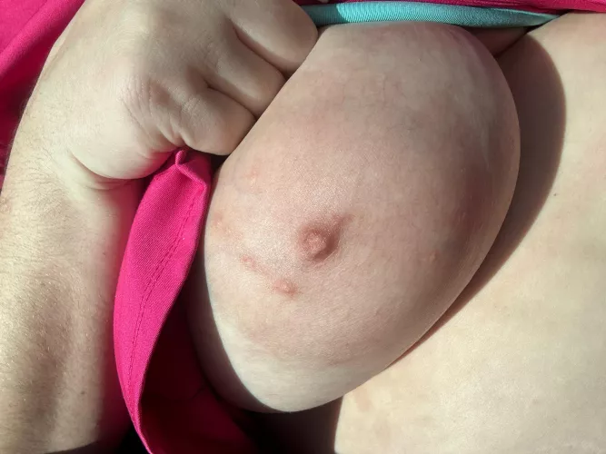 Let her out for some sun by Large_Badger8317