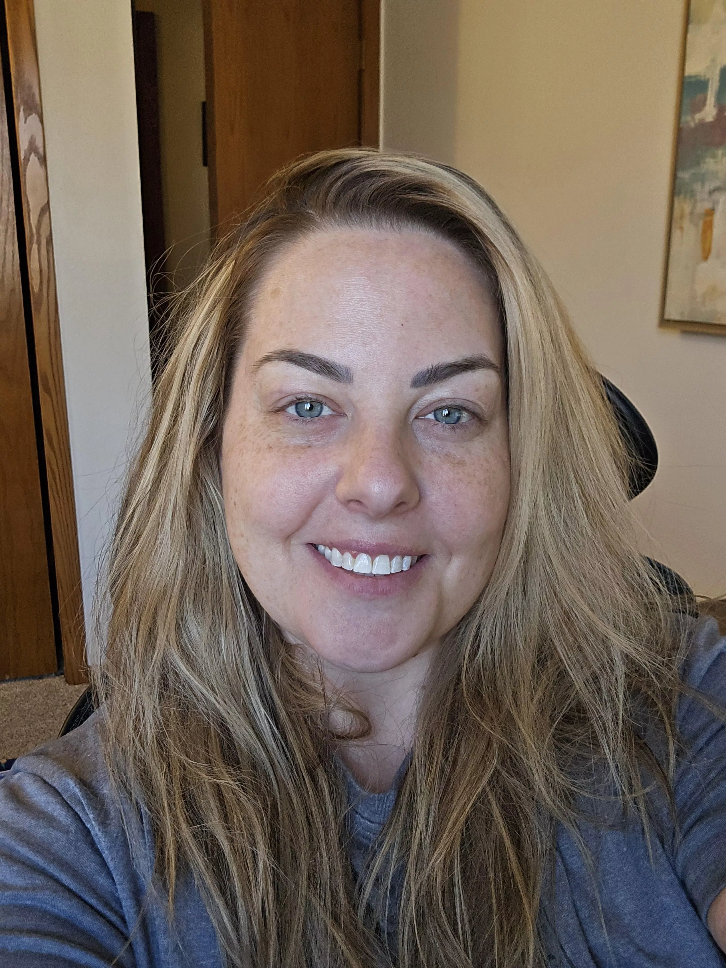 Freckles out posted by Swimming-Escape6945