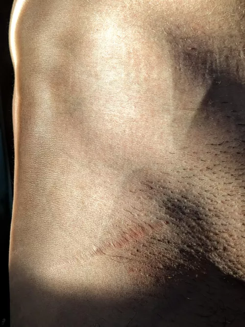 Body shot by BloodDrenchedTampon