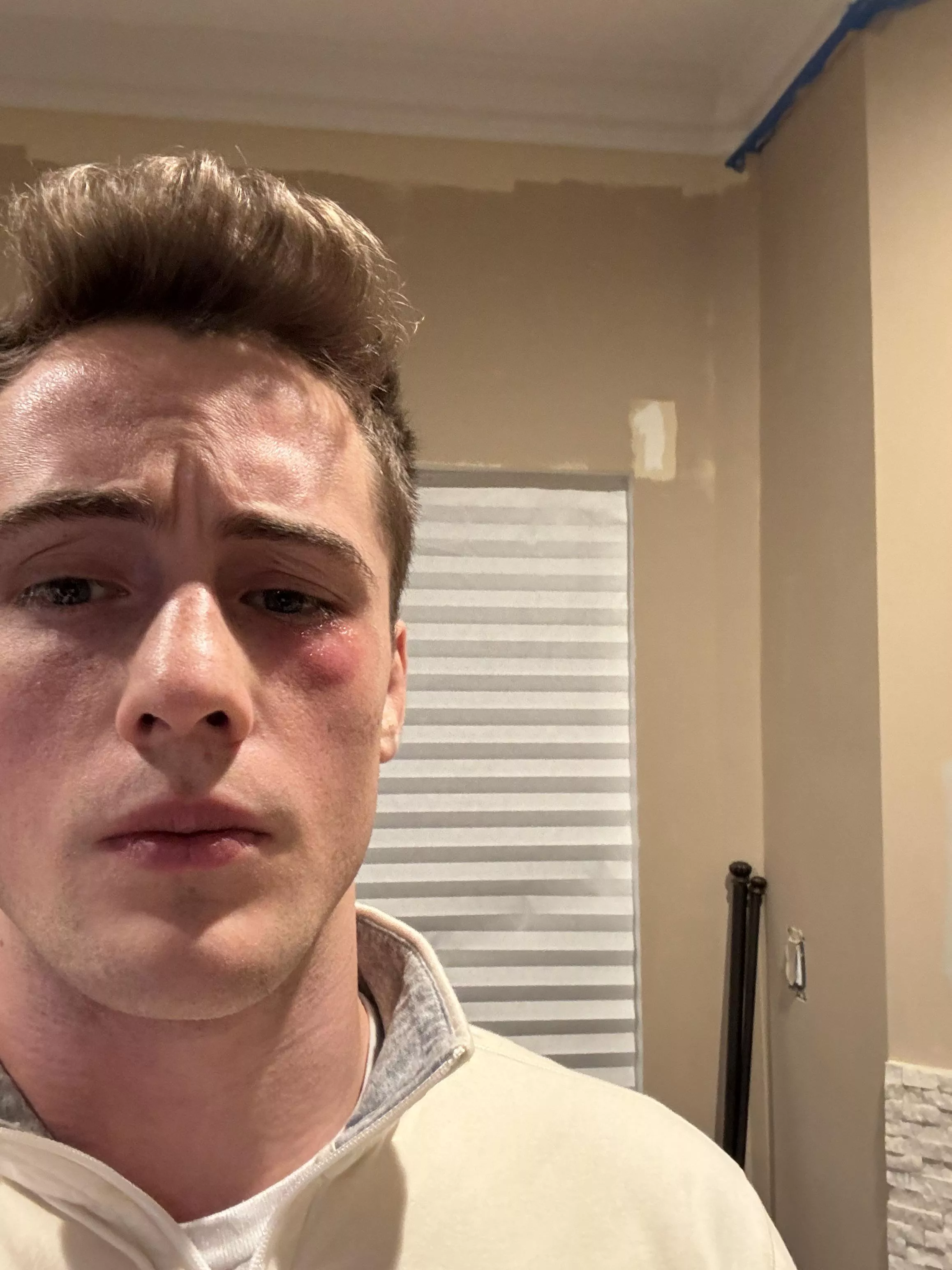 Got staph from wrestling practice so no date for me on Valentine’s Day😂 posted by Kingof_the_matt