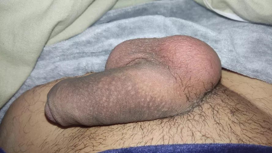 Help with my skin color by CRSVL