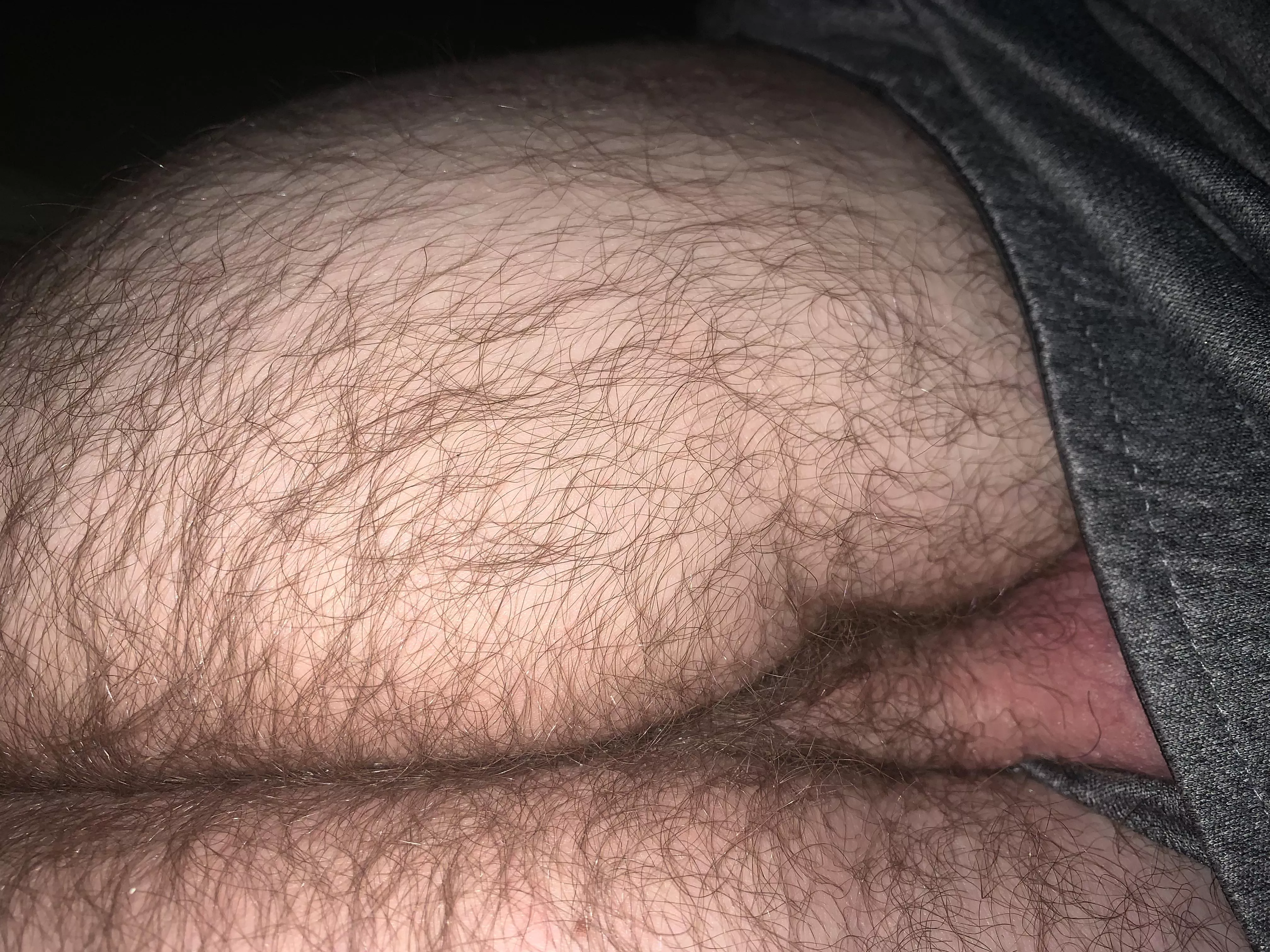 Quite a bit of hair I think posted by Few_Huckleberry_9337