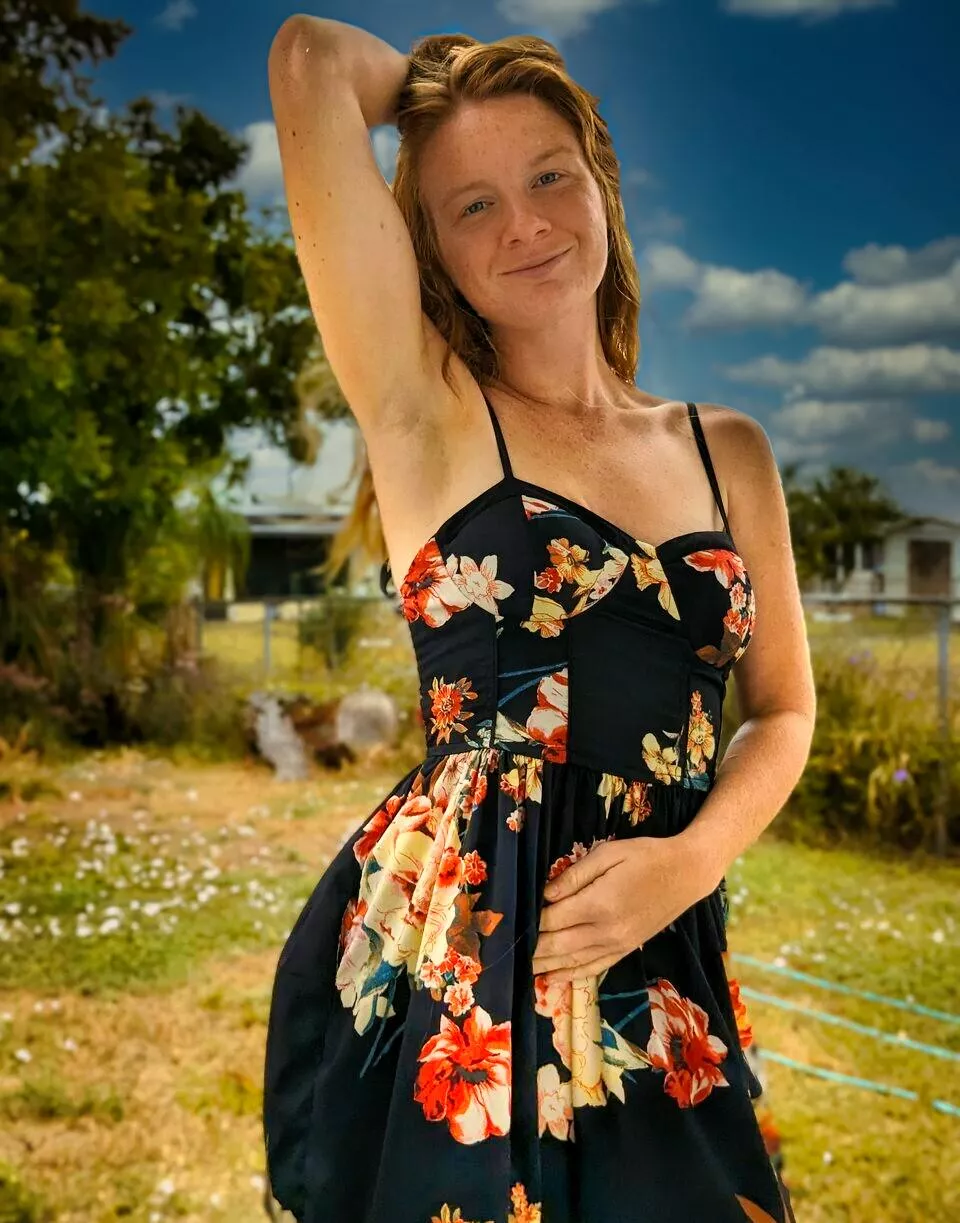 Sunkissed freckles and summer dreams @redlilyrose19 posted by Redlilyrose