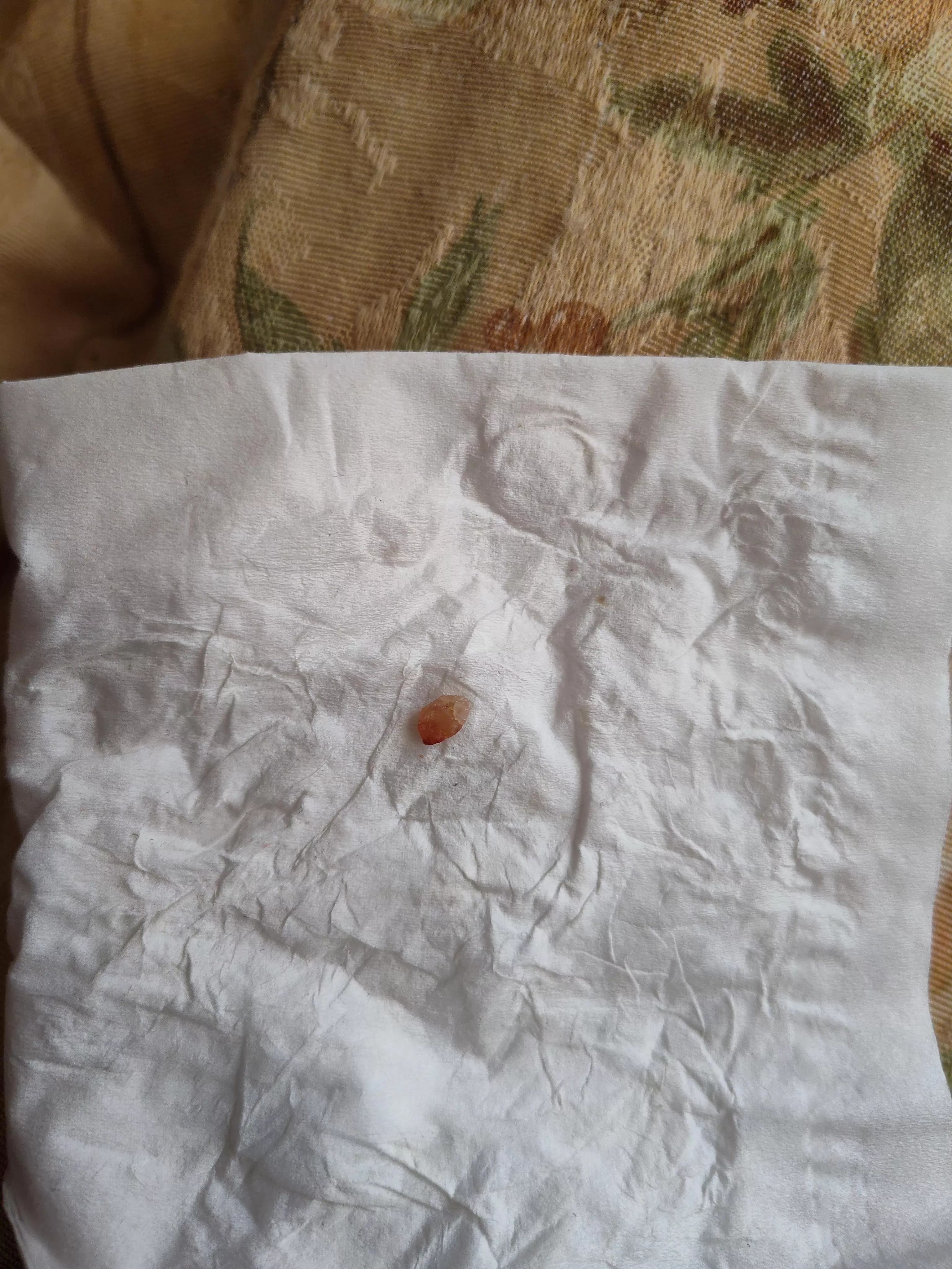 A rather odd cyst core. posted by esprockerchick