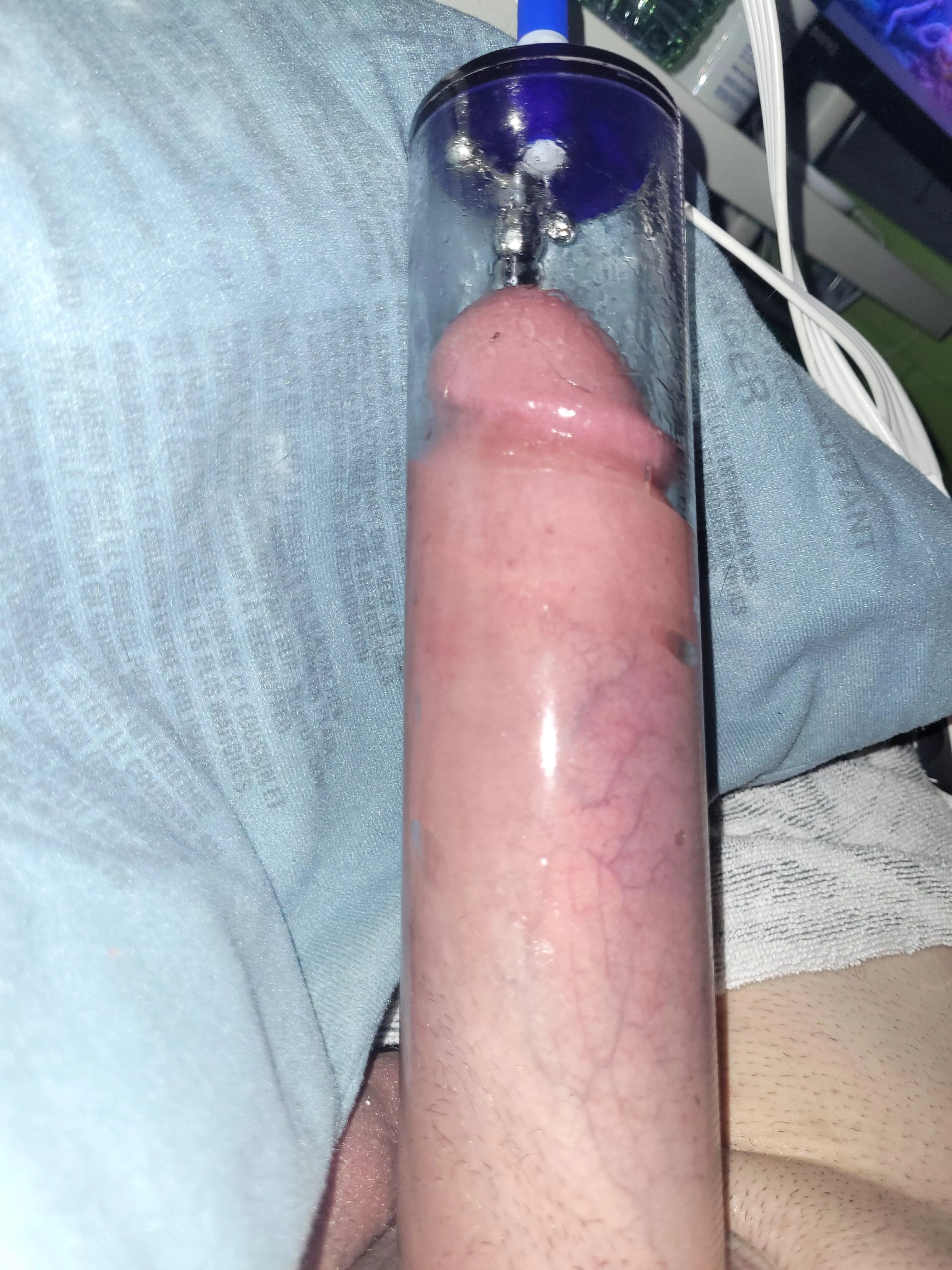 Heatpads on LOW really help with expansion. posted by aspex0anon