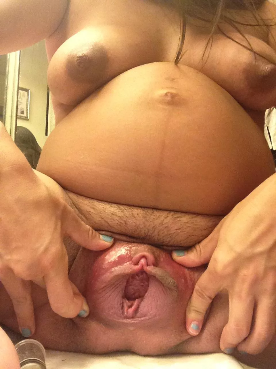 Puffy pregnant cunt posted by Acceptable_Analyst_4