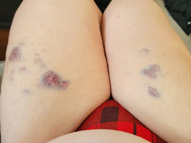 Amateur masochist here — received a nice flogging by my  domme :) by CaptainCellulose