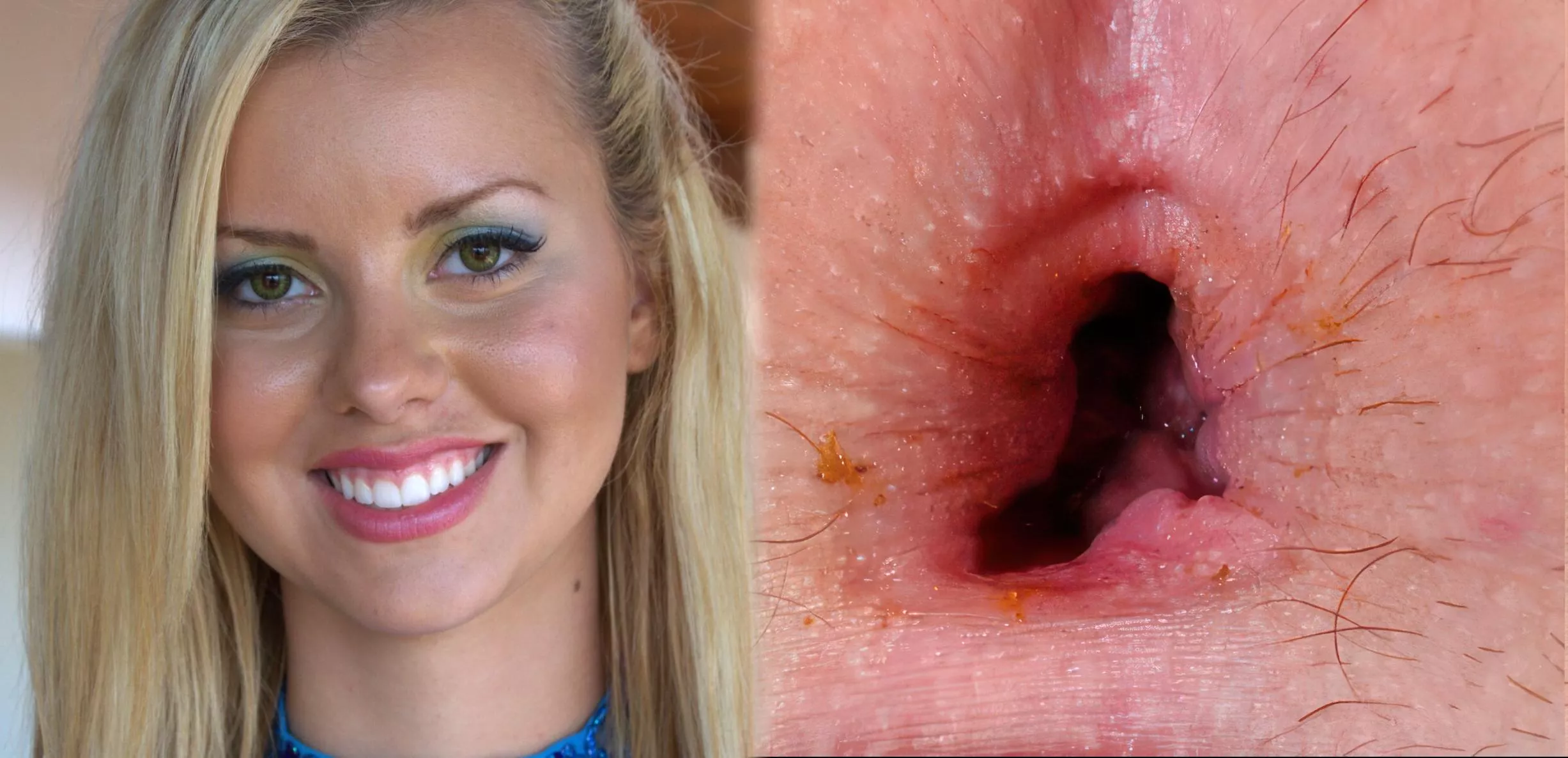 Pretty face, pretty hole posted by Destined2SuckAsshole