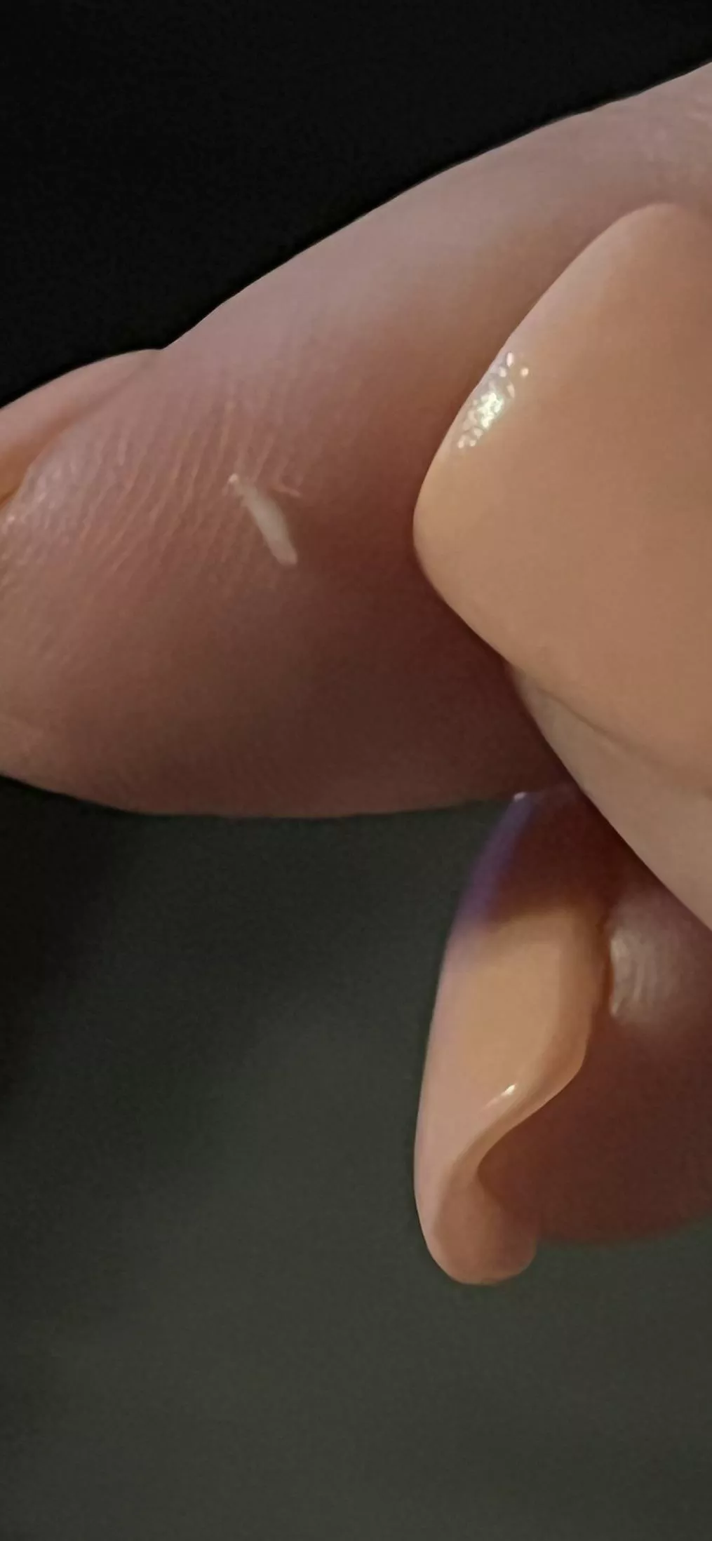 Weird plug I pulled out of the middle of a cyst on the inside of my thigh. posted by KaylaRocksss