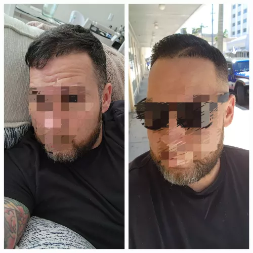 (38m) Before and after  by JJFreakShow