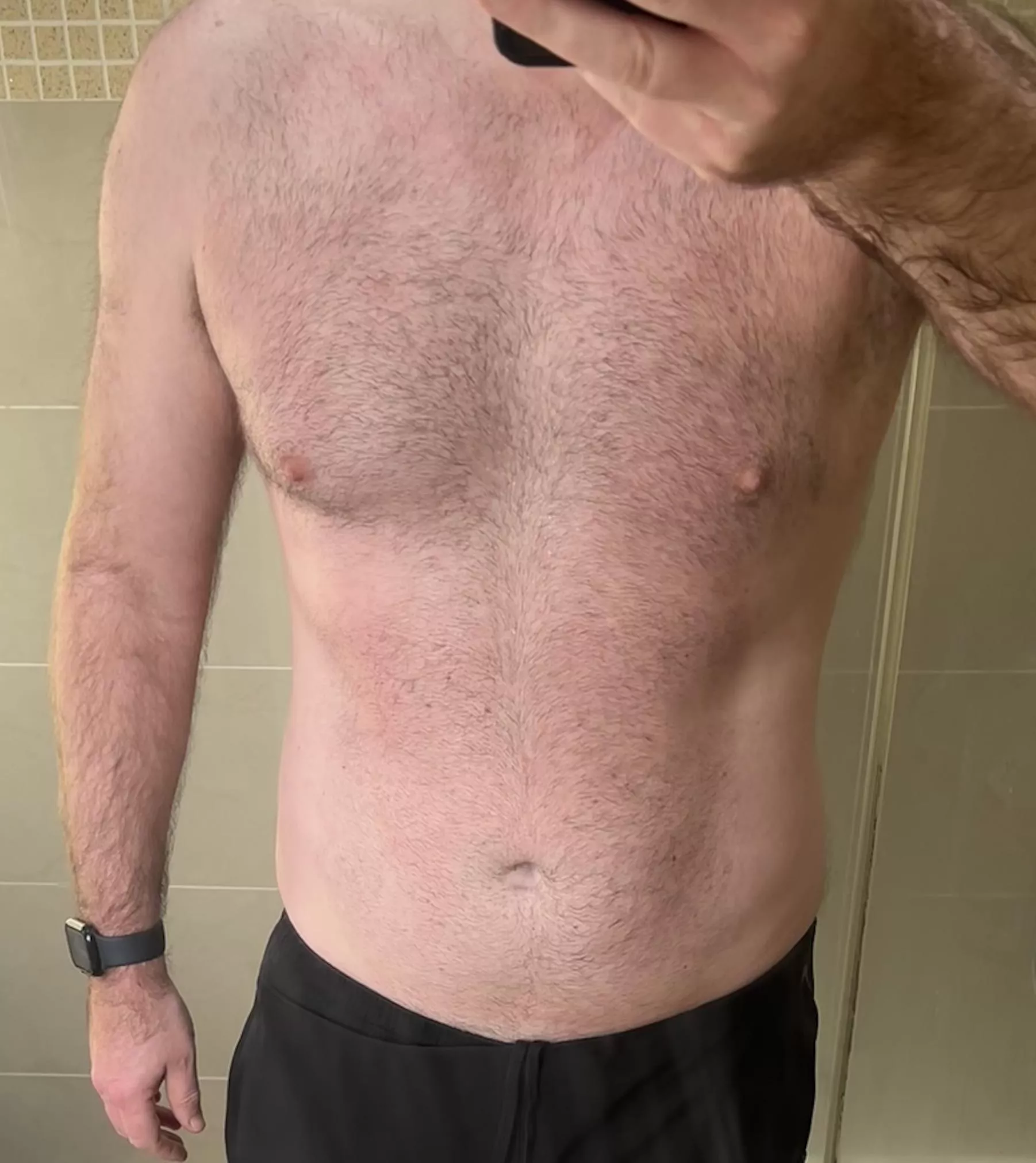 [46] Gone mild, for now posted by talldad789