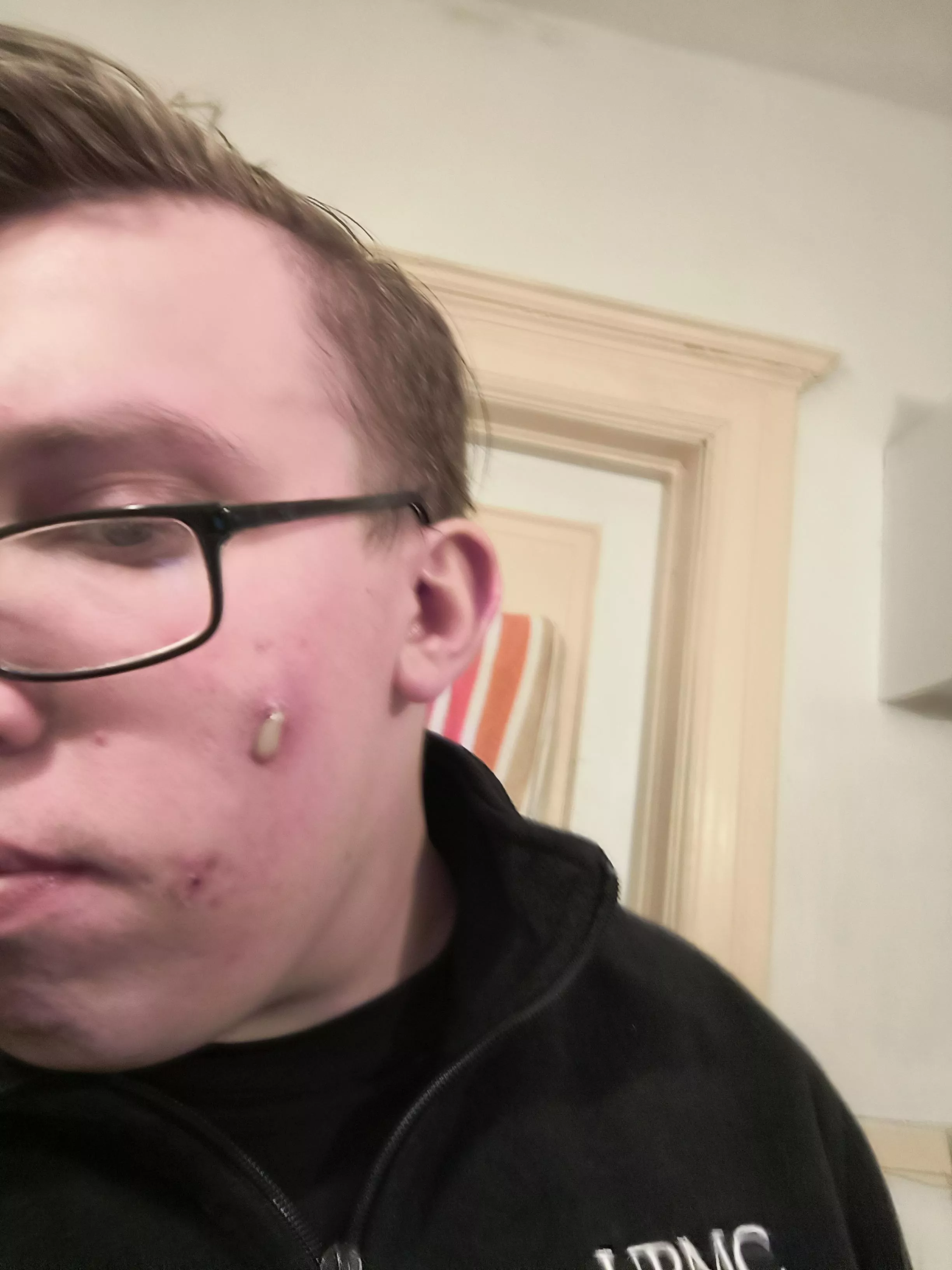 Face stuff. Been using cervae, doxycycline and face wash twice a day.  posted by Moist-Mix-1161