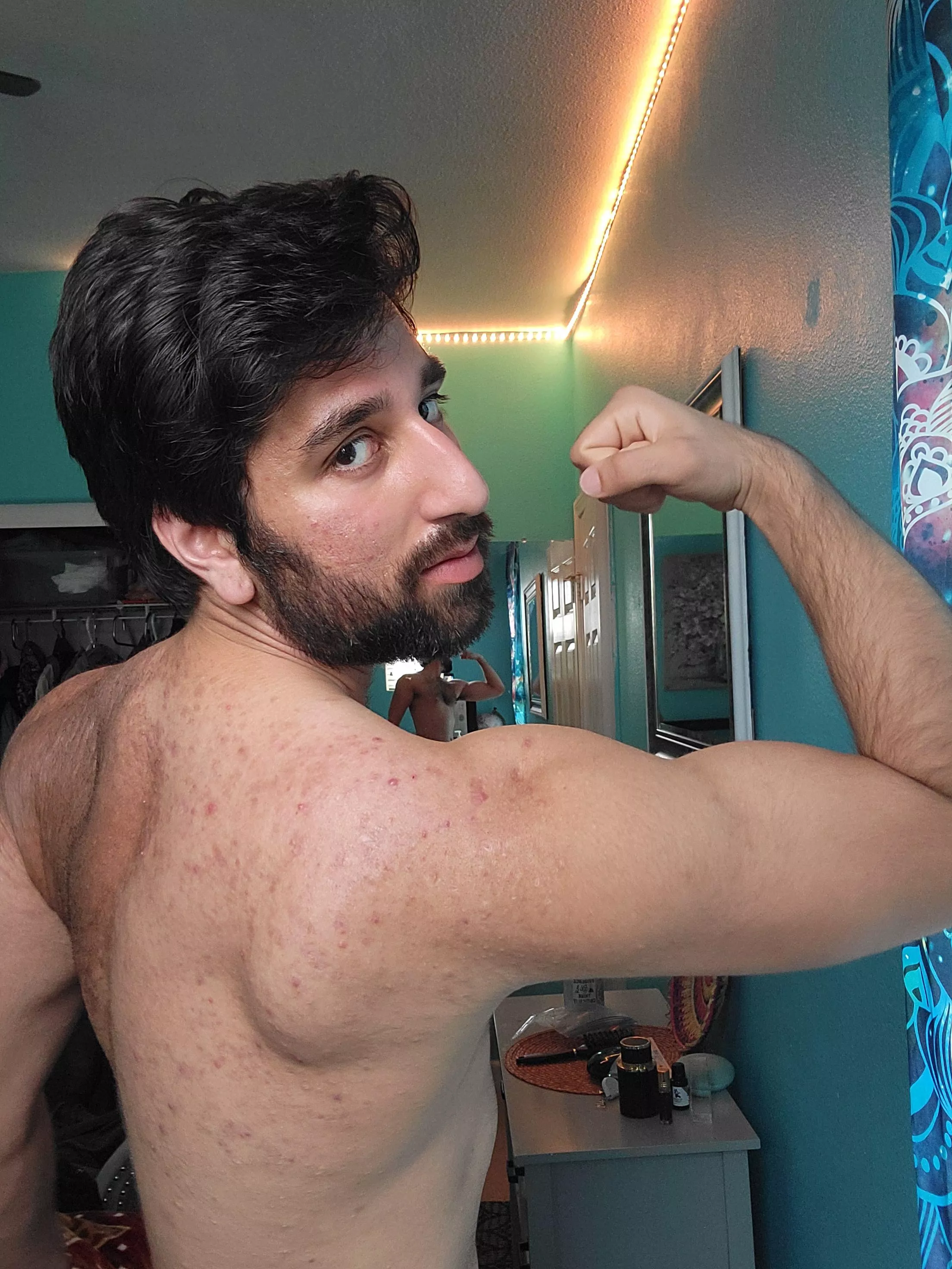 I got a lot of bacne but my back has never been this toned ever😩🙏 posted by senseisenpai1