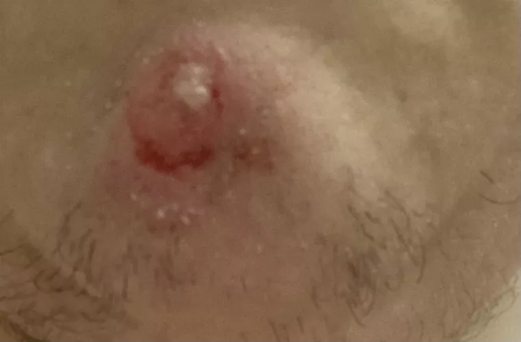 I want to pop it so bad by Candid_Wash