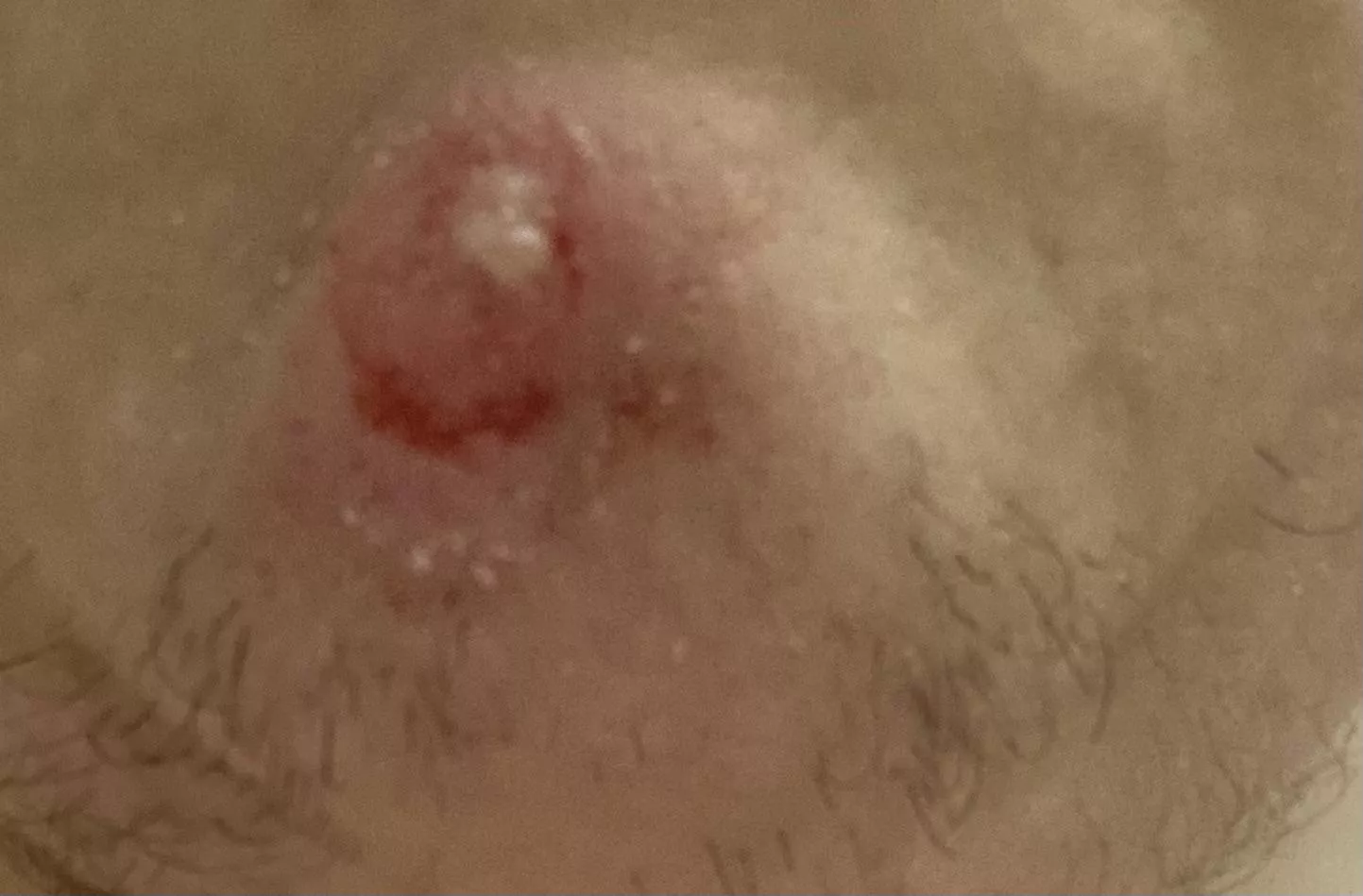 I want to pop it so bad posted by Candid_Wash