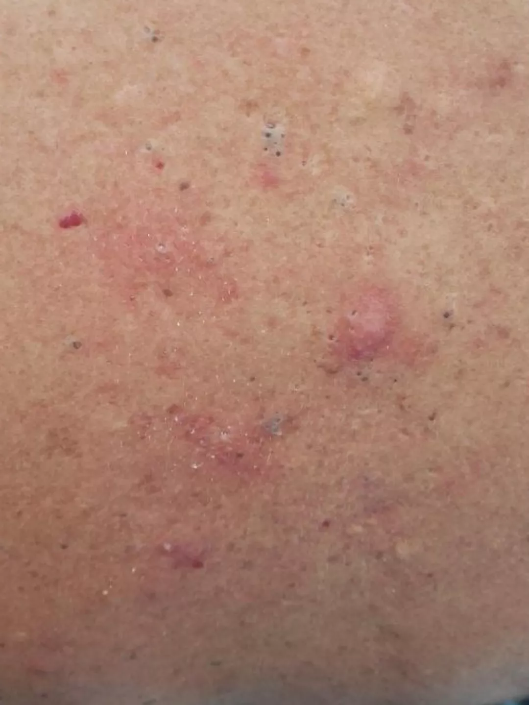 The back of a family friend posted by juloath