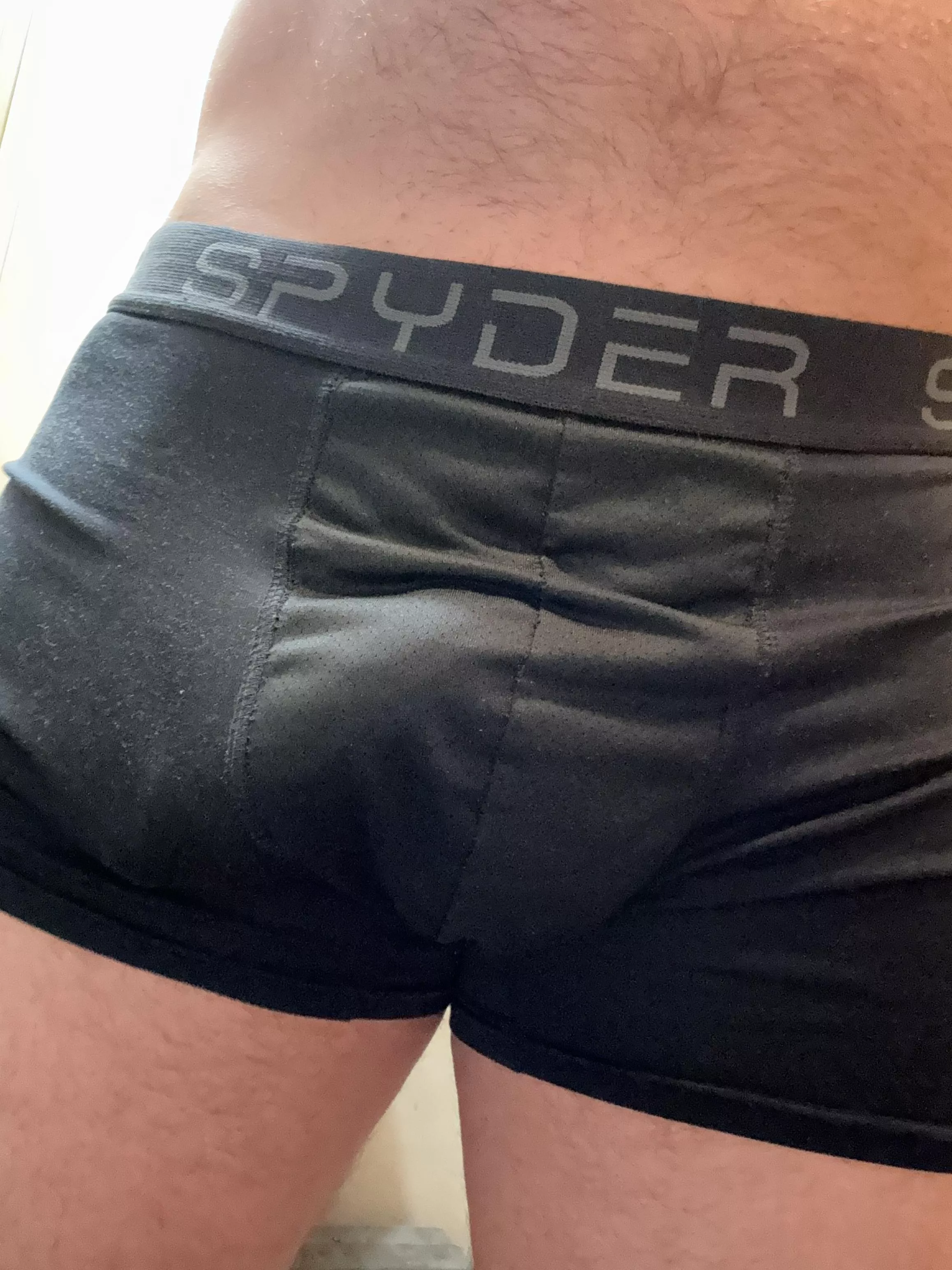 Can you see where it ends (soft bulge) posted by try_it_again4