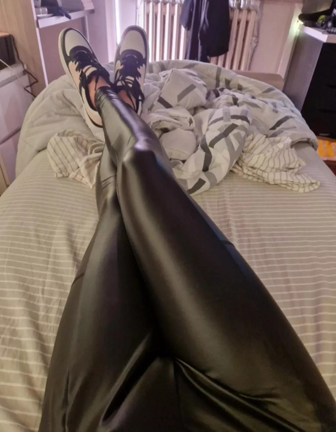 What would you do to my legs? posted by pregnantbee69