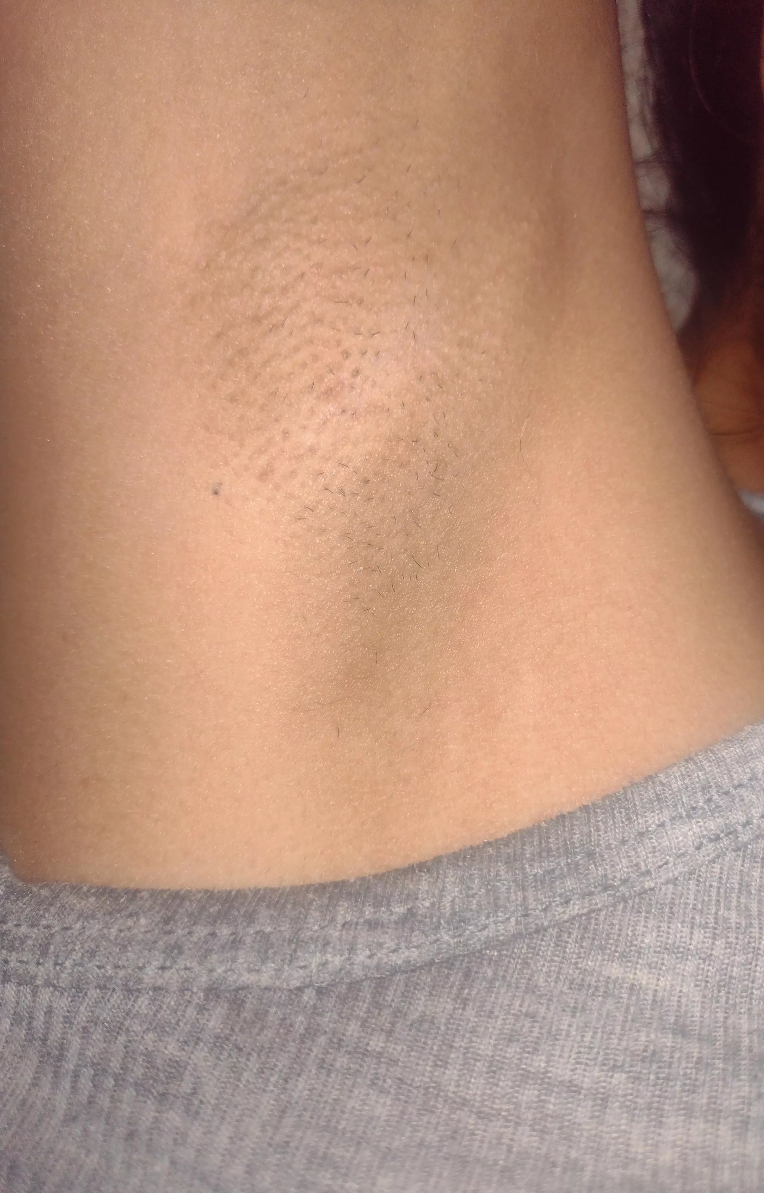 Hmm smelly  posted by peachybbe1