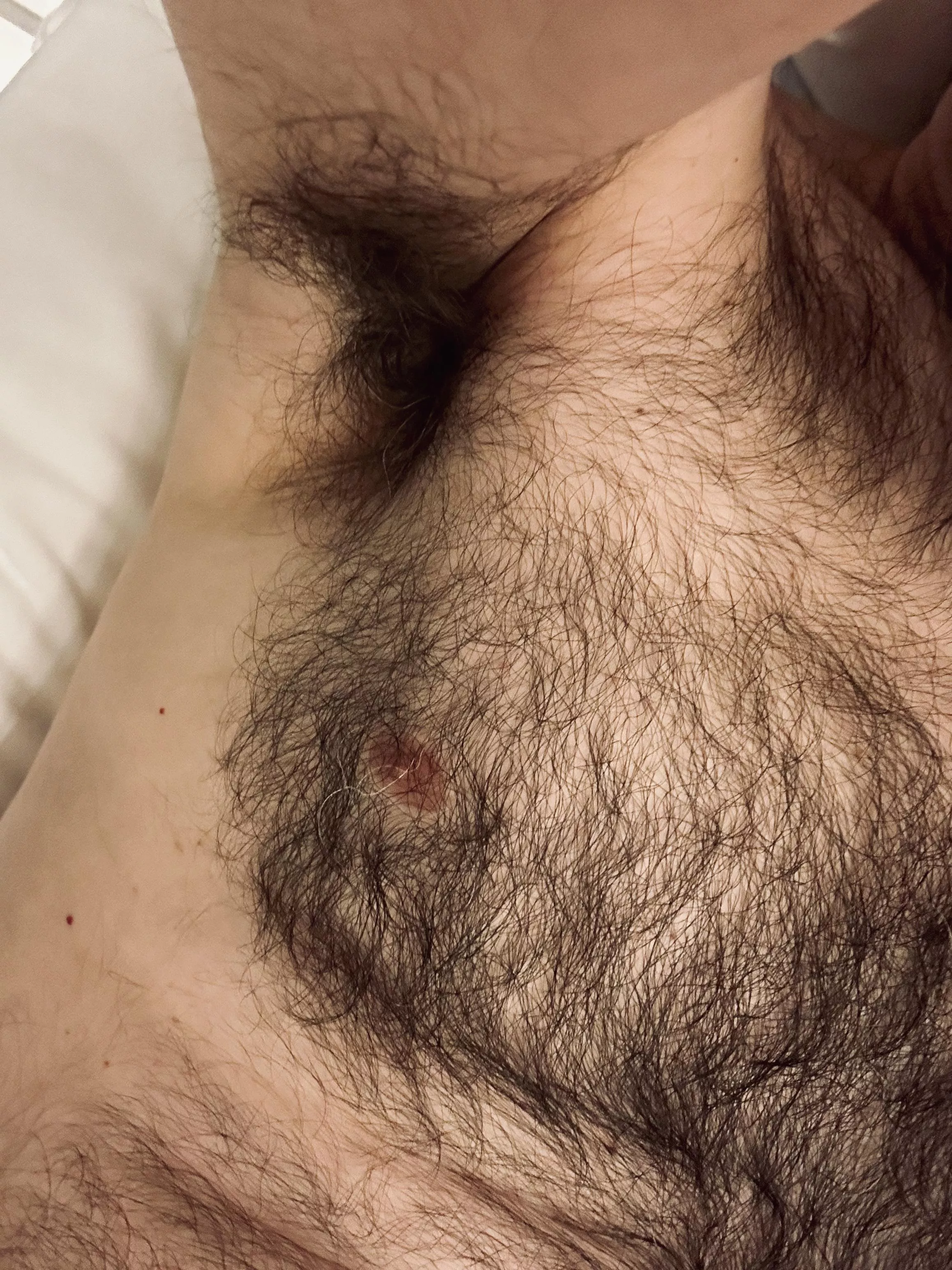 My pits blend into my tits... posted by jerseyjaxoff