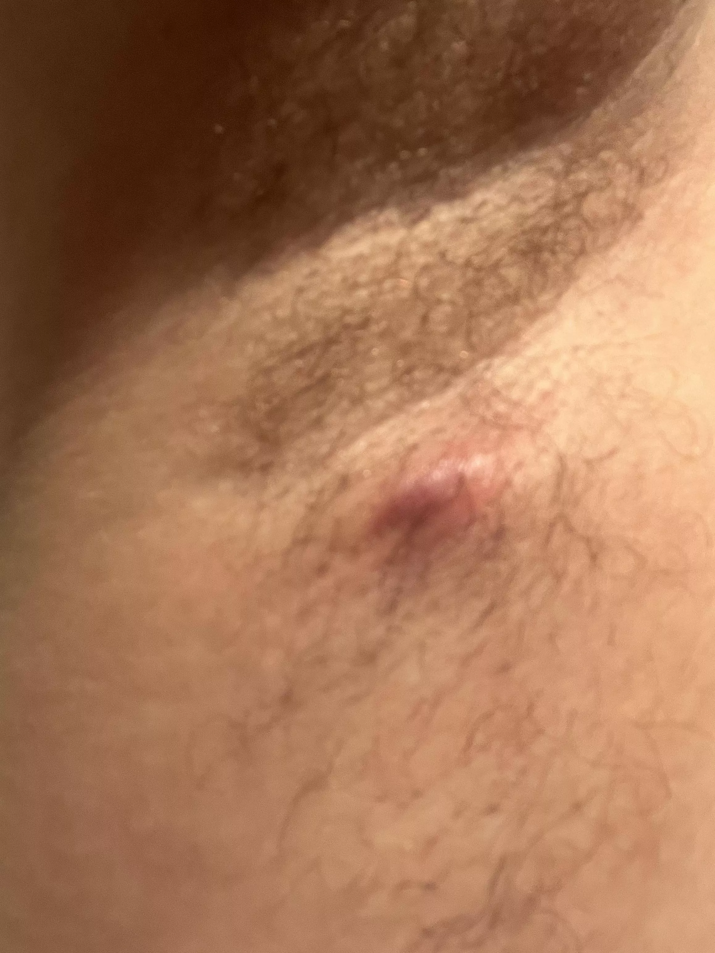 A guest appeared under the arm posted by inoahsark456