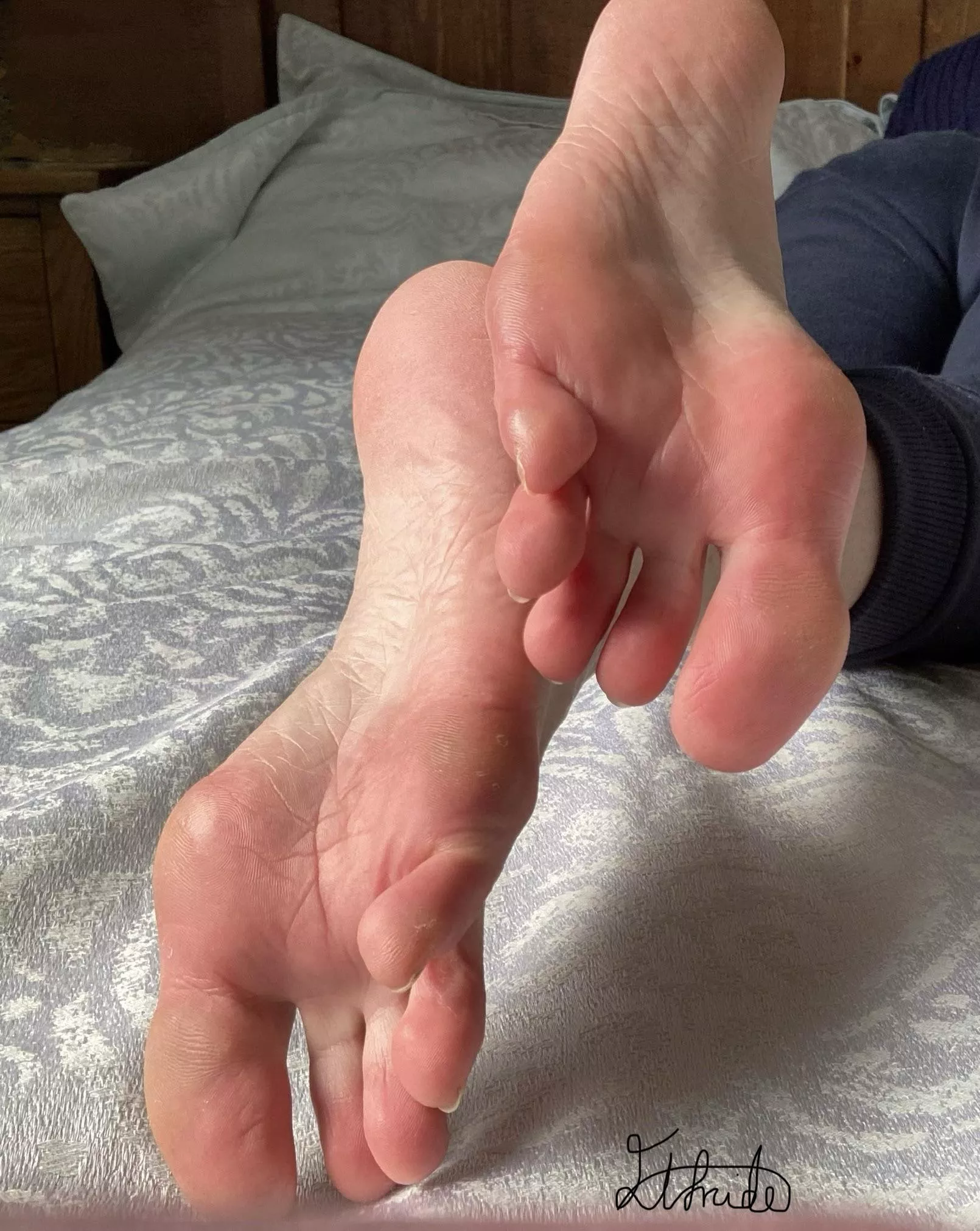 High arches and soft soles  posted by Elfrida77