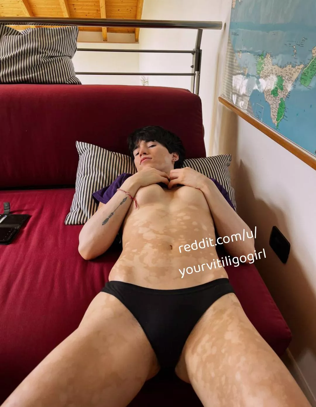 Xia (@yourvitiligogirl) [onlyfans] posted by yourvitiligogirl