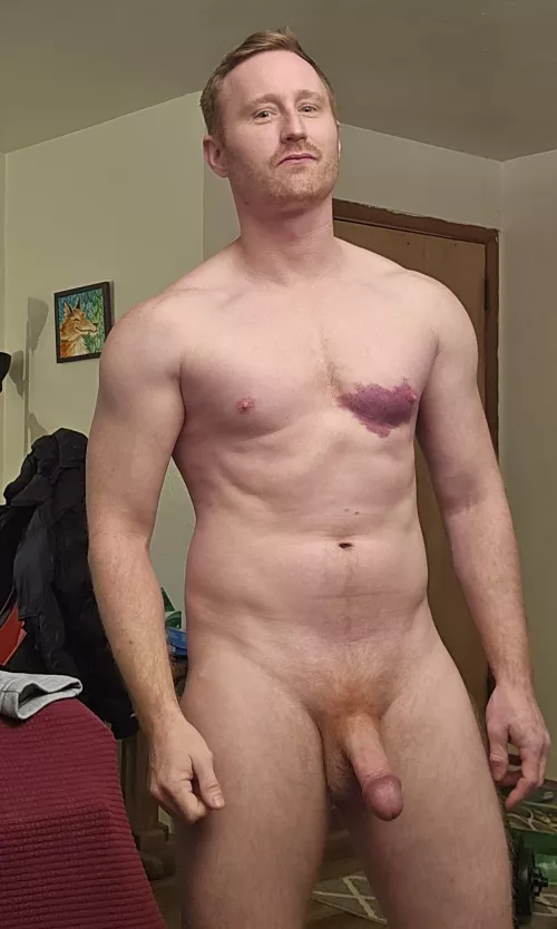 It's a birthmark and I call it my bleeding heart by PMMeUrSelf