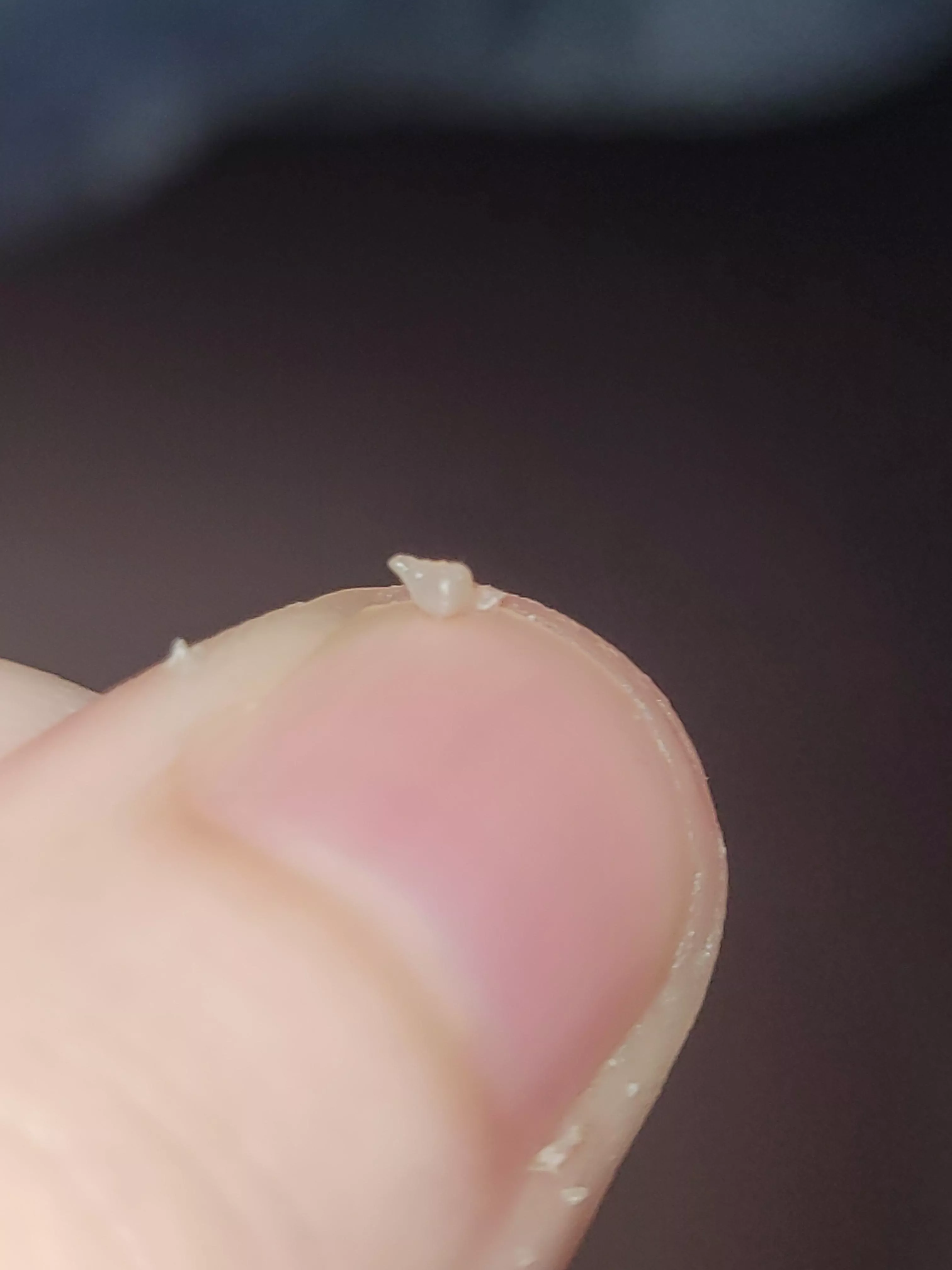 This came out of my piercing today posted by how_does_this