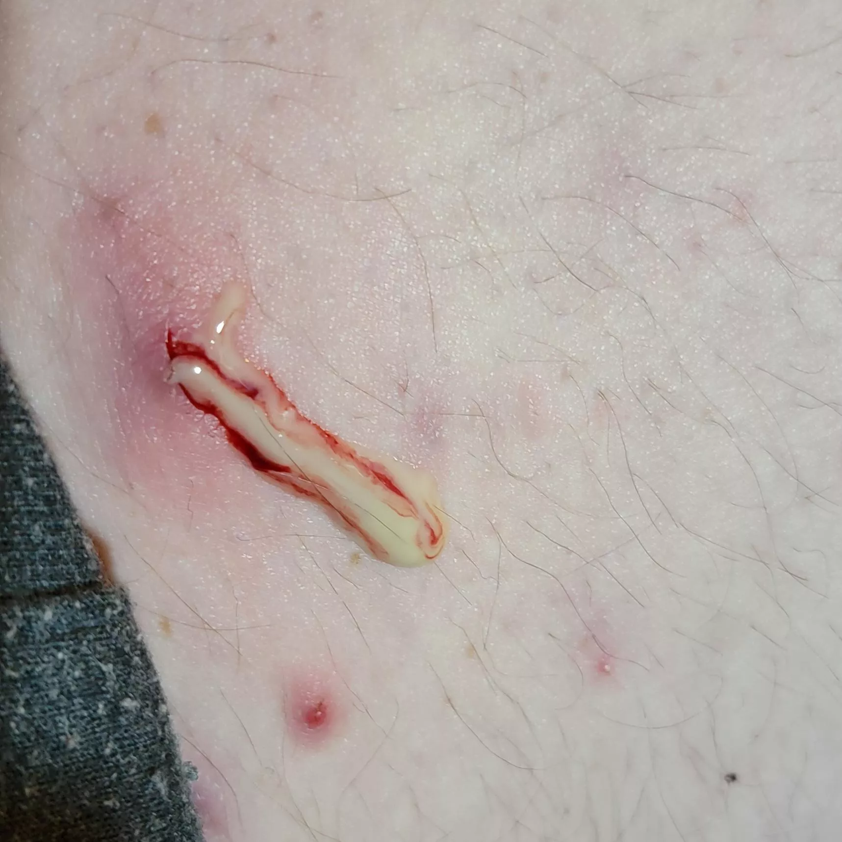 This. F##king. Hurt.... posted by derp4532