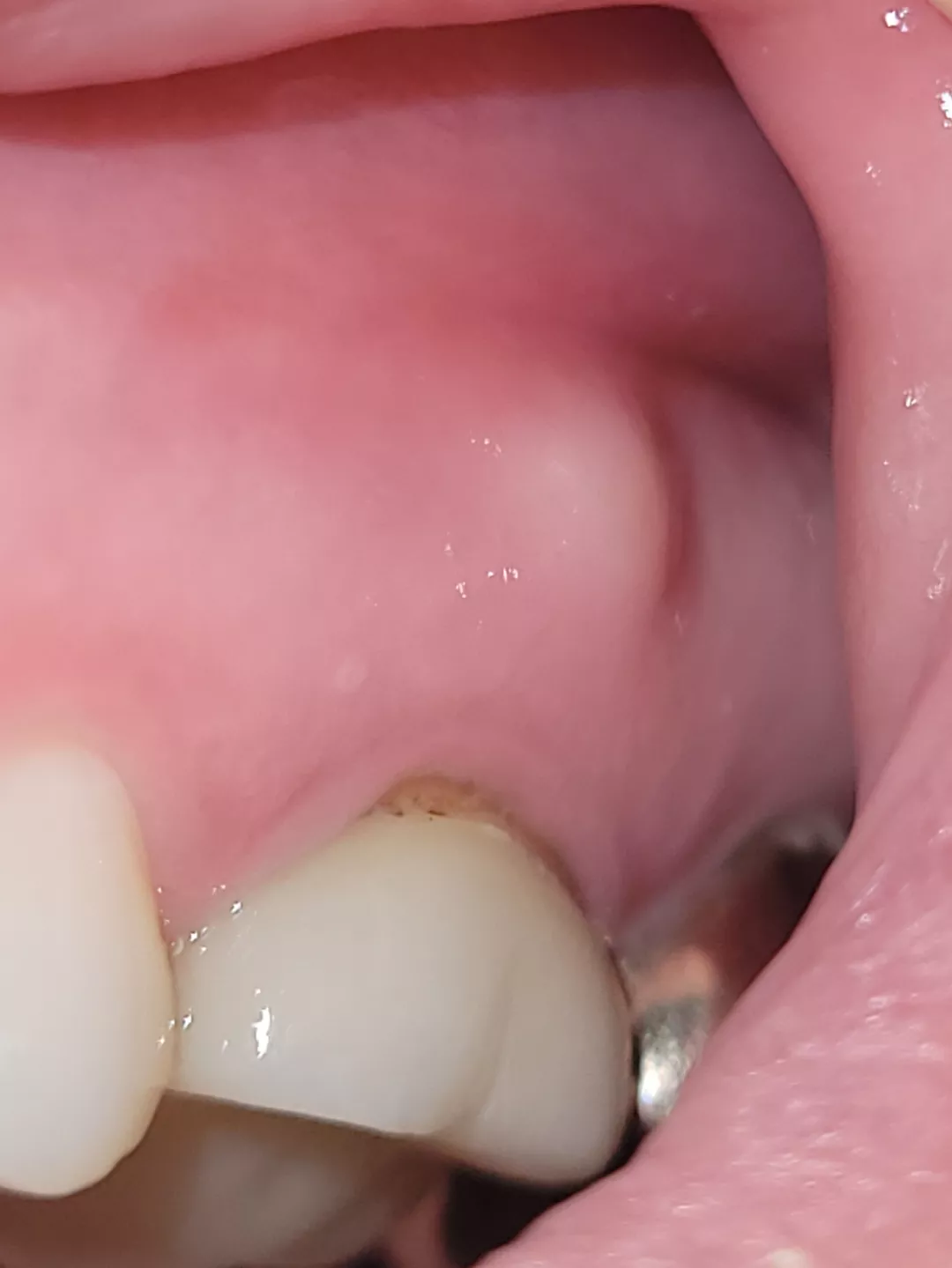 The Forbidden Gum Pop posted by Zillibean