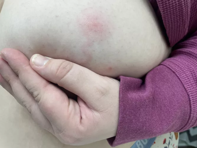 Unfortunate and now forbidden boob pop by cat_coven