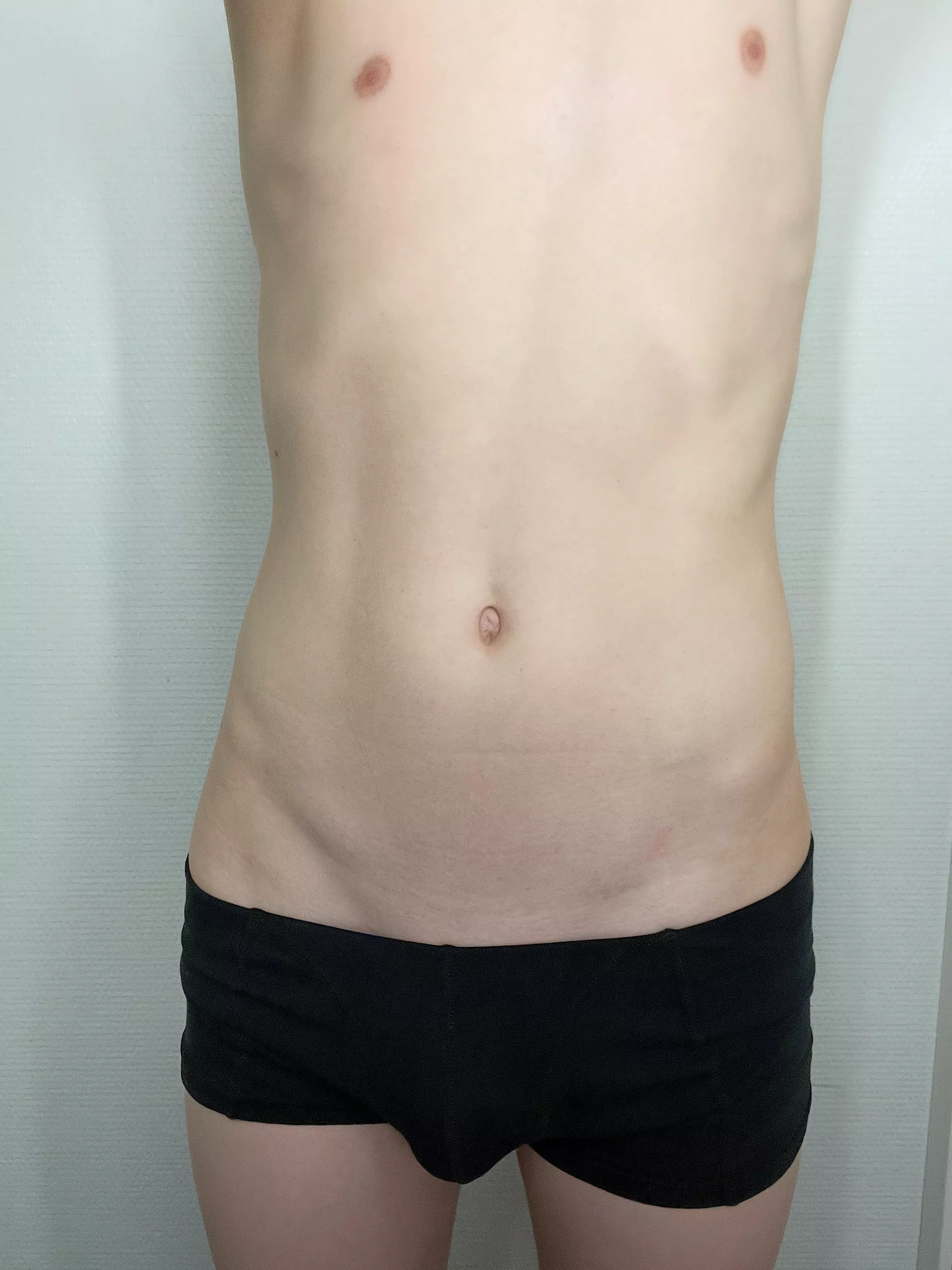 freshly 18yo im not sure of my looks posted by dailytwinker