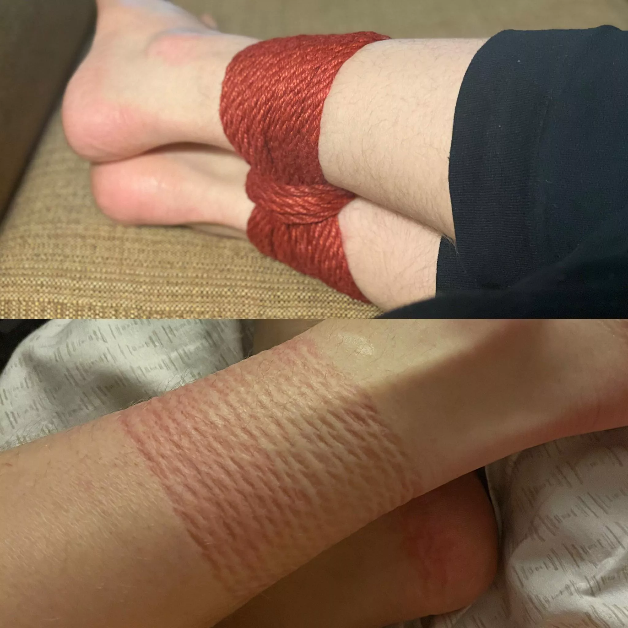 The rope markings afterwards are always my favorite. posted by LordGodiva22