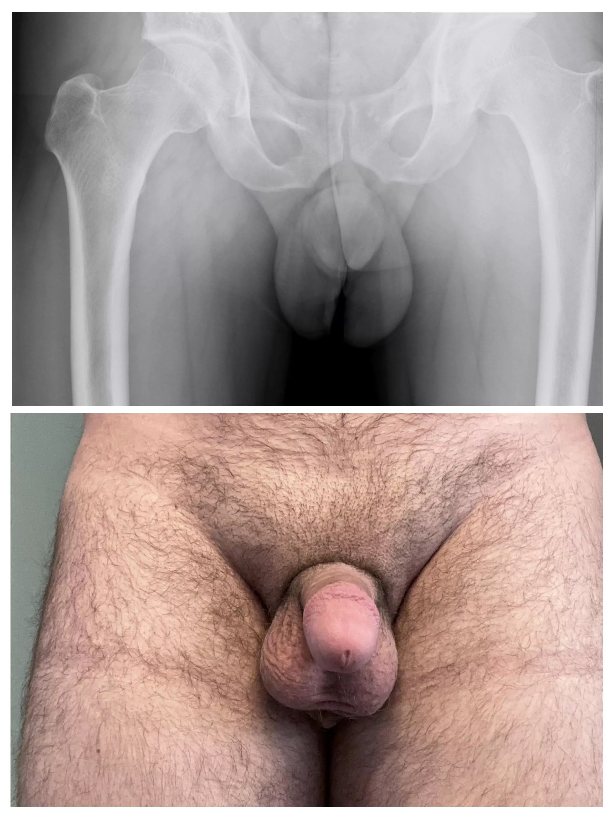 X-Ray Softie and Normal Softie. posted by thrownawaysince95