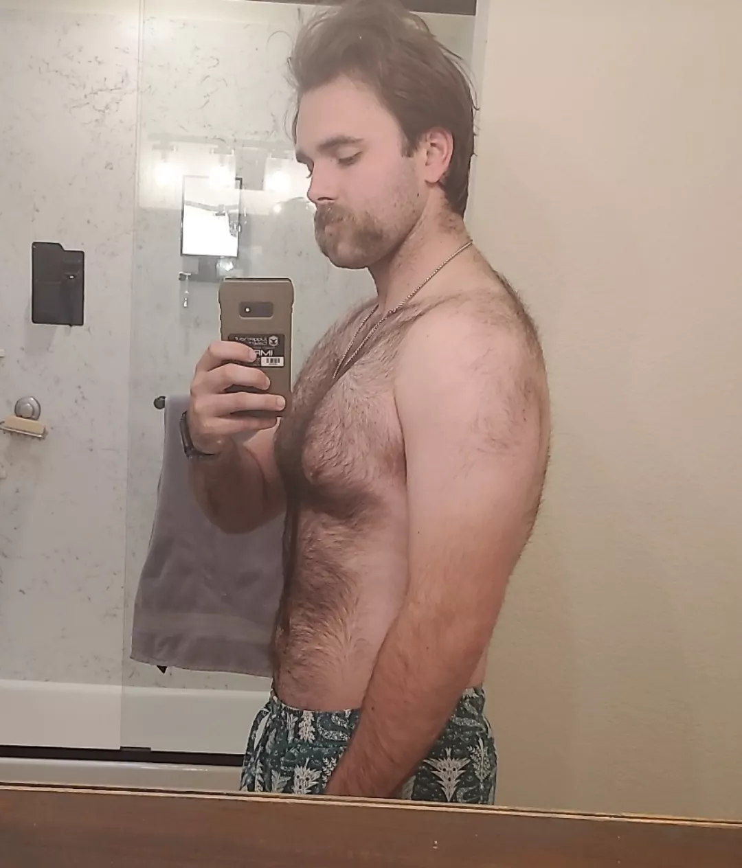 I literally woke up looking like this posted by Sac_townthrowaway