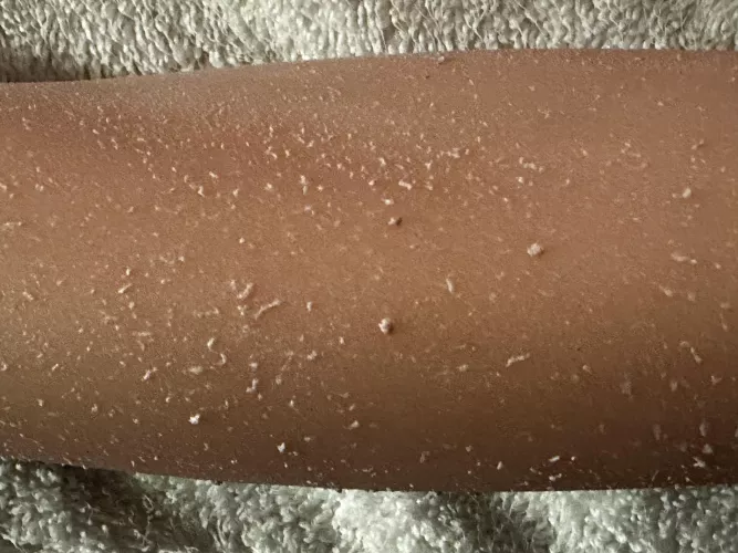 Need Help with Doll Skin Problem by Unusual-Option-6662