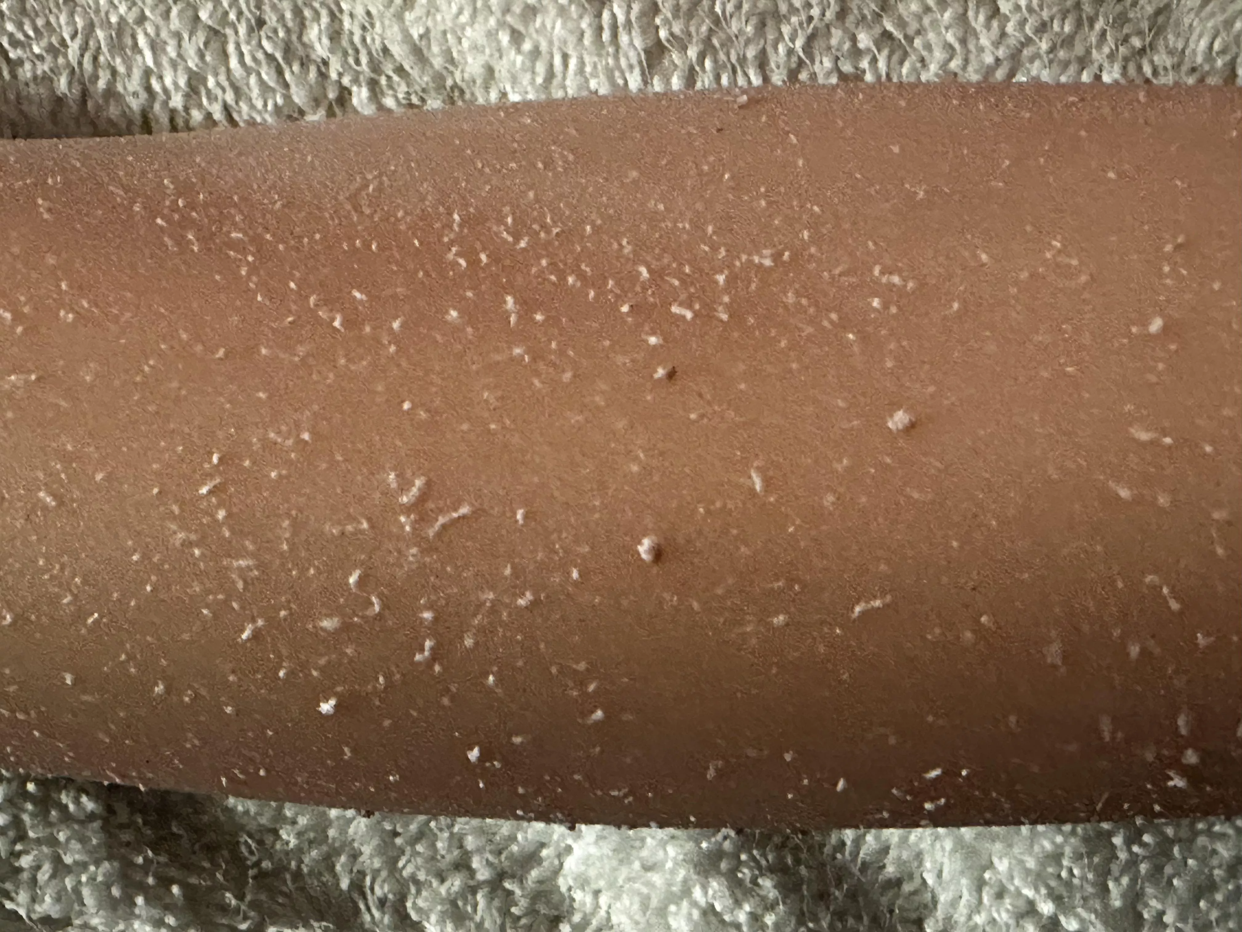 Need Help with Doll Skin Problem posted by Unusual-Option-6662