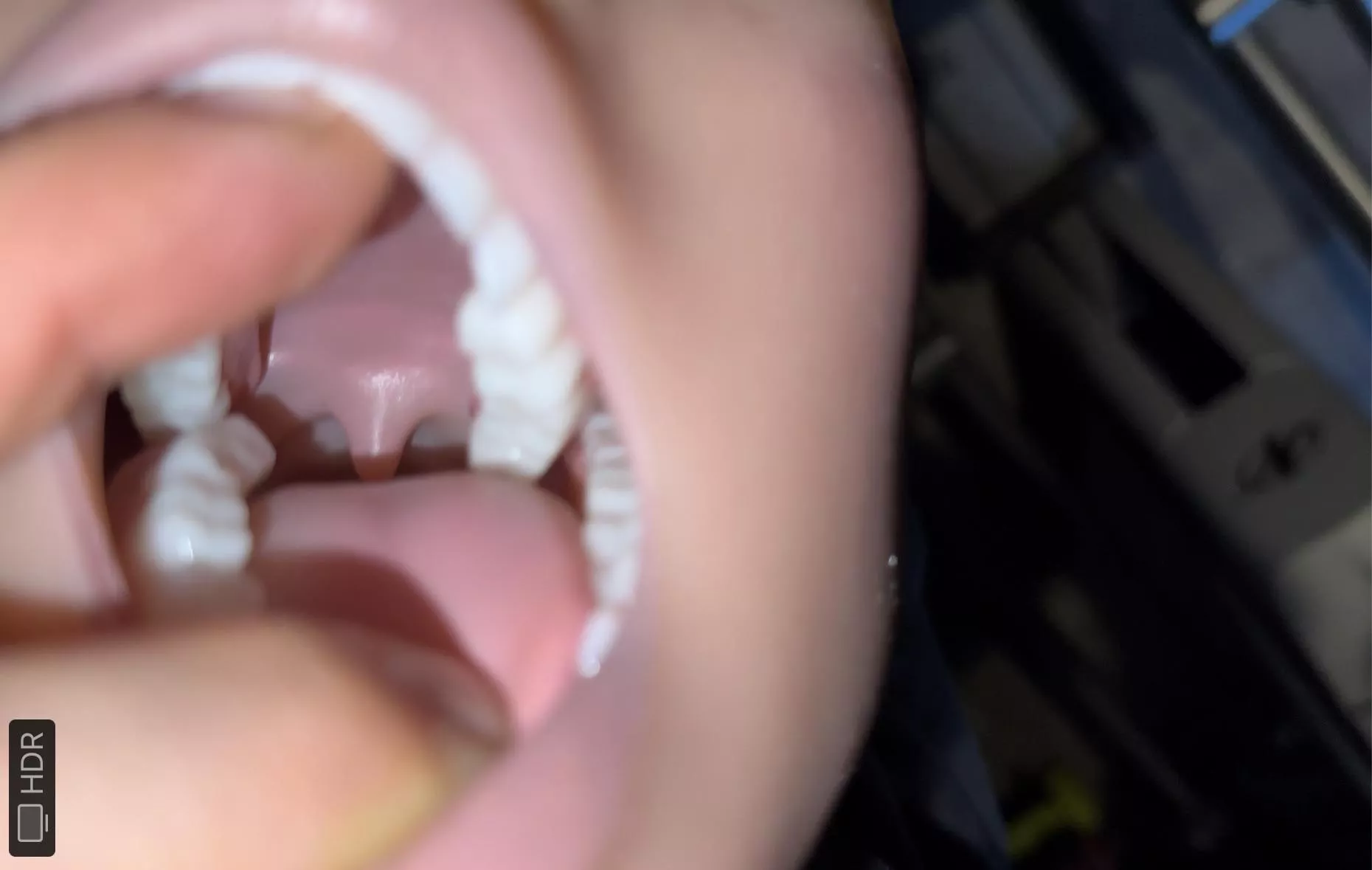 look at this!! 🤤🤤 posted by captainuggetla