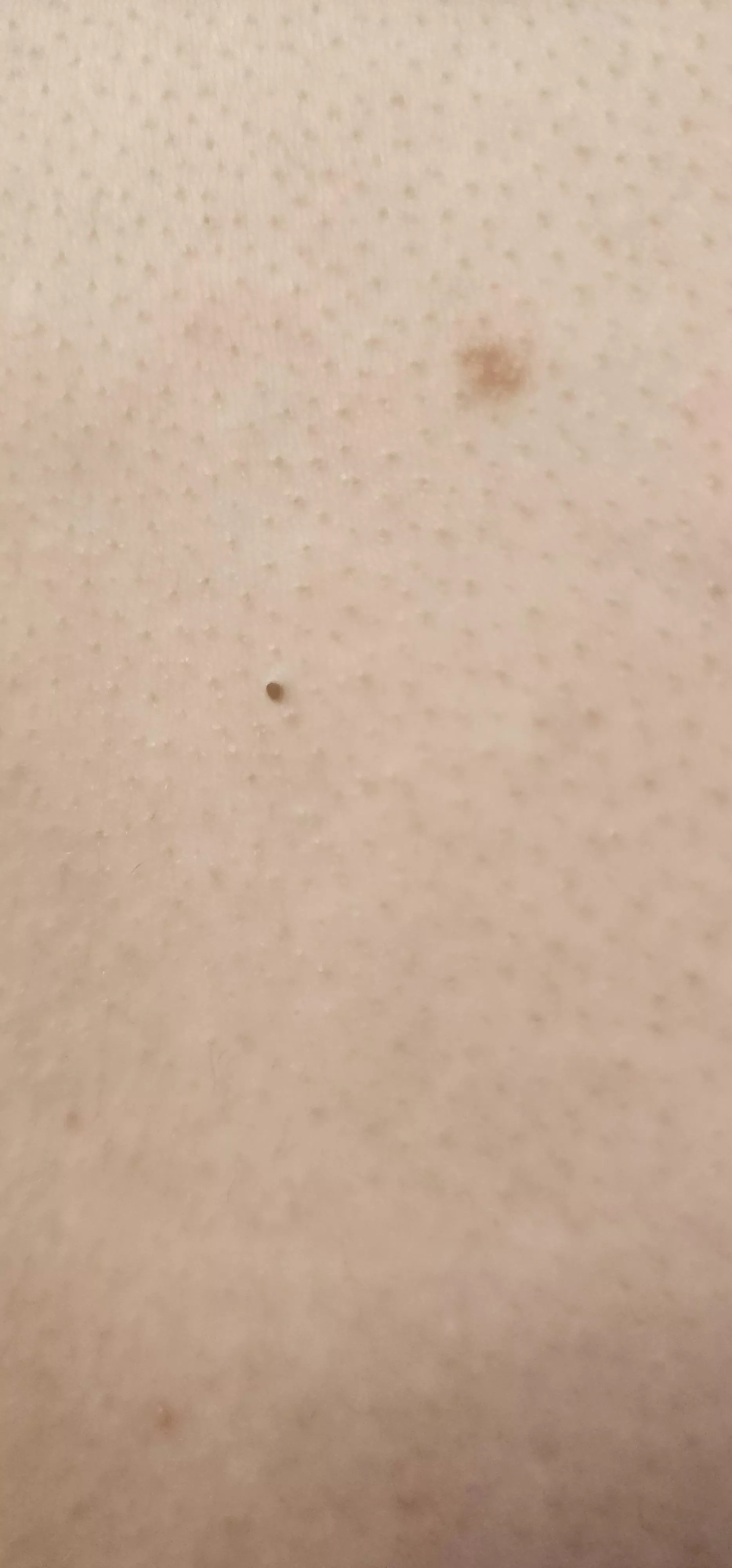 I so wish my roomie would let me pop this blackhead. You can tell it's a fat boy. posted by Prior-Building5640