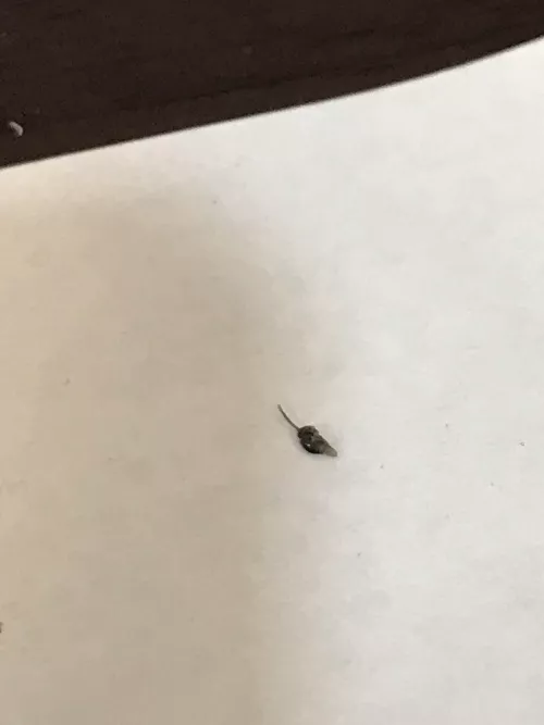 Is this ingrown pubic hair normal? by Sea-Bite9908