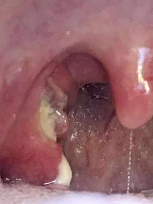 The day after suspected Quincy... by Butterflies_Suck