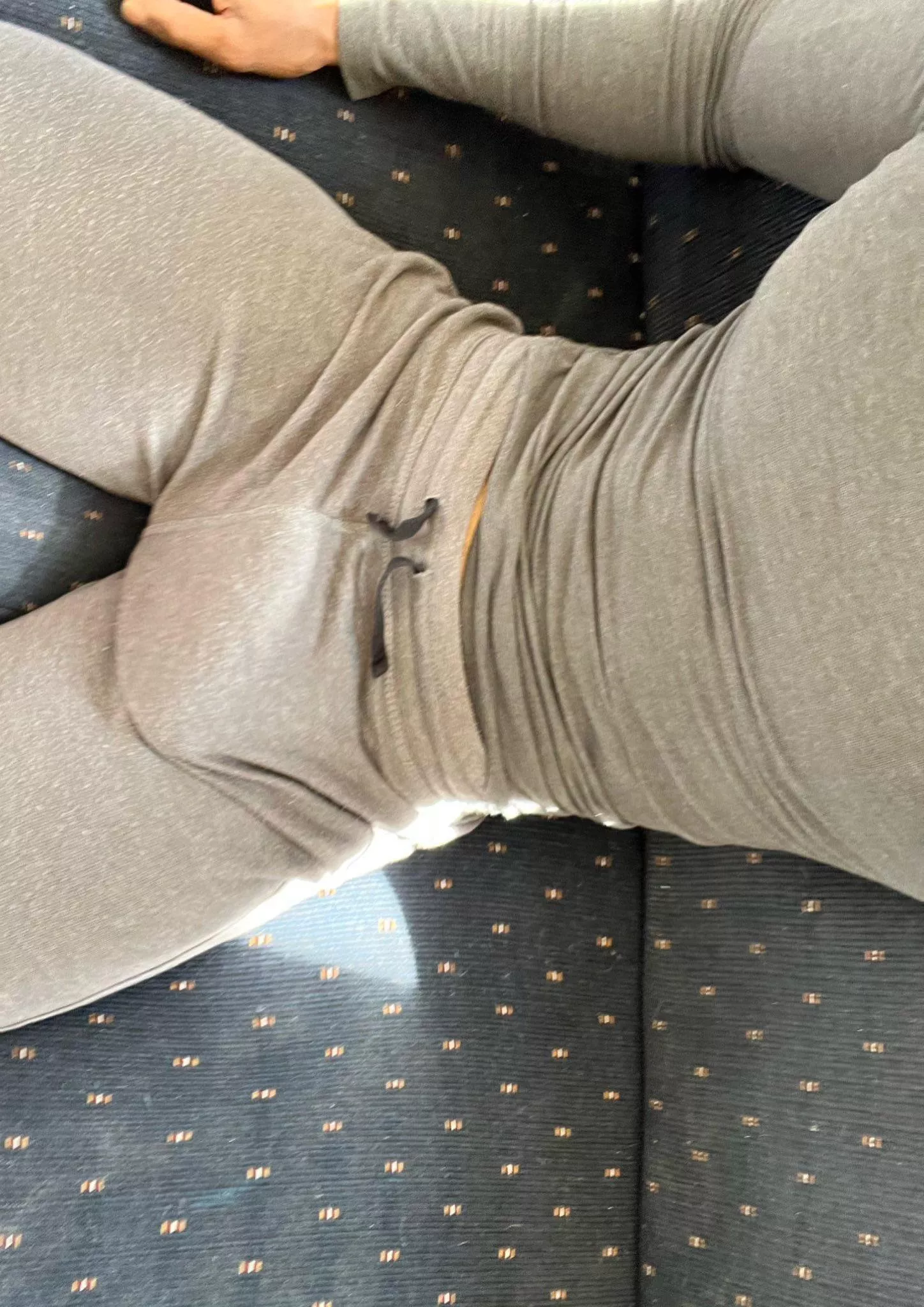 You think i’m bulging? posted by Ok-Yam-8301