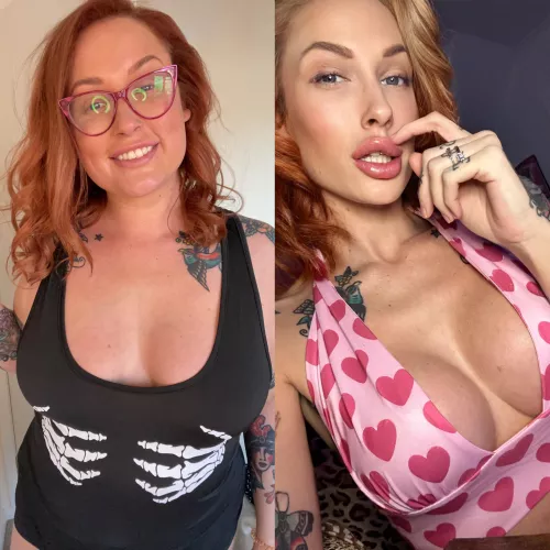 3 years between pictures, should I get more lip filler? by kenma91