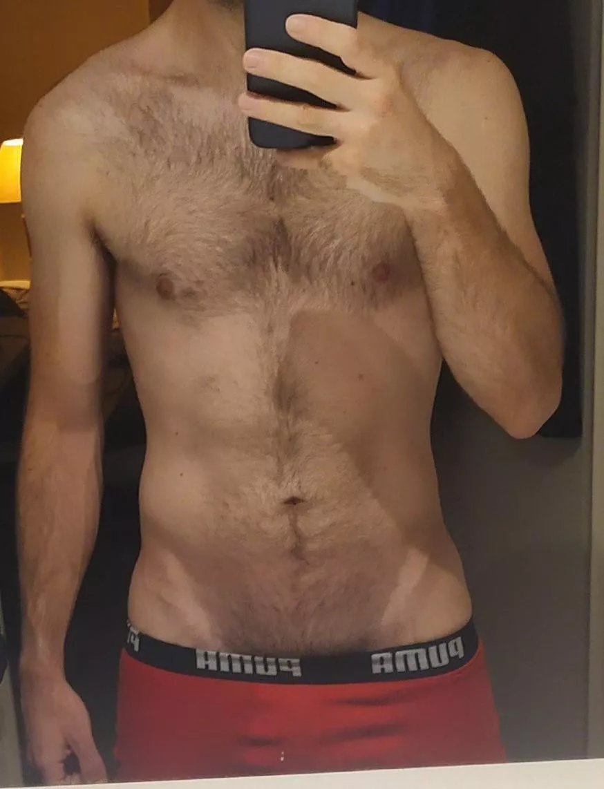 Do I pull my boxer down lower? posted by Willau2