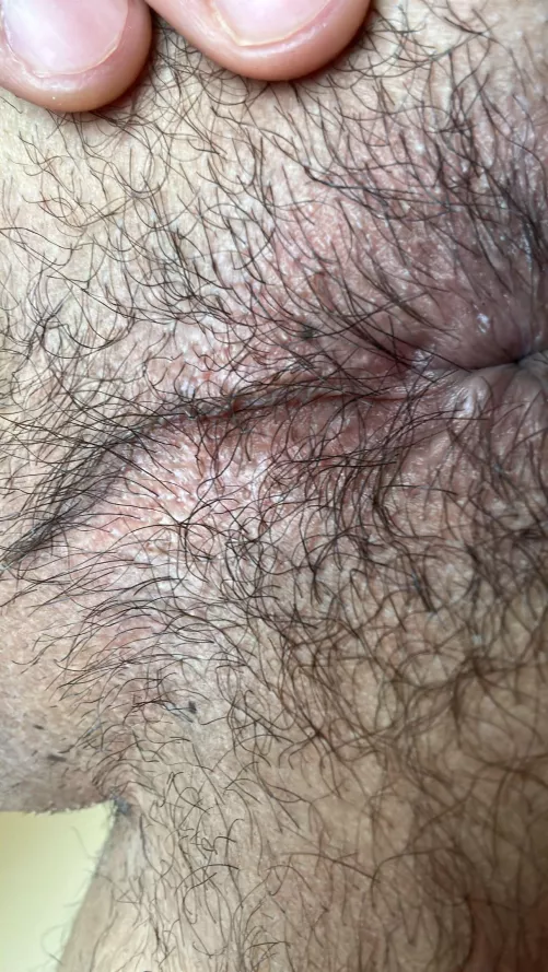 Hairy ass zoom in. Twink 25 by ArmandoPerez69