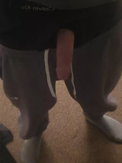 Poking through my boxers by Chemical-Worker-1224