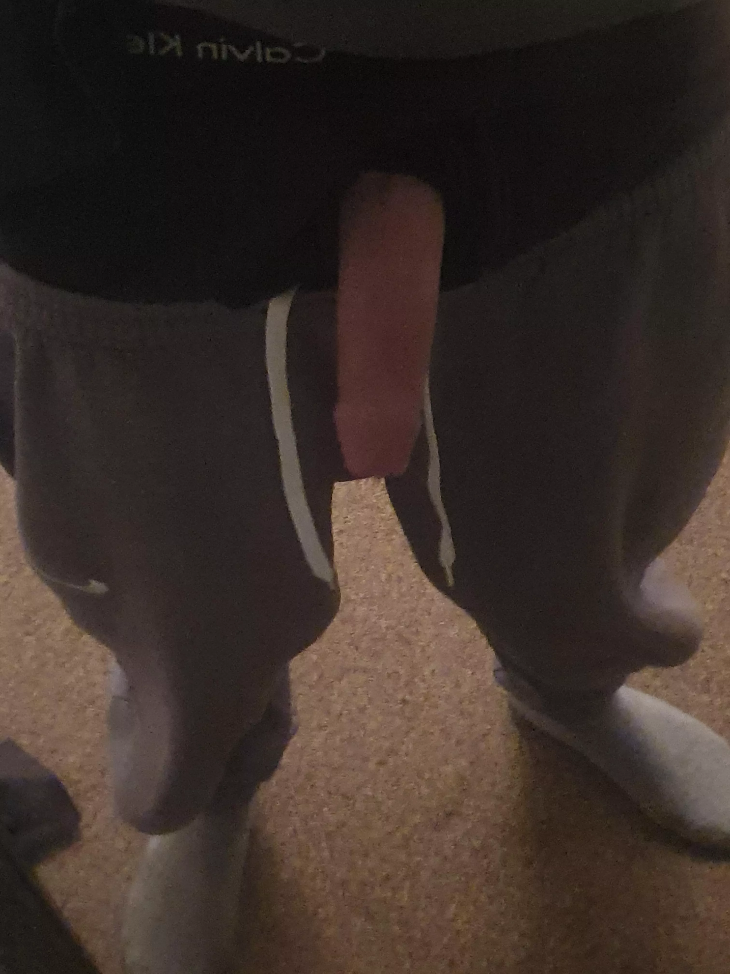 Poking through my boxers posted by Chemical-Worker-1224